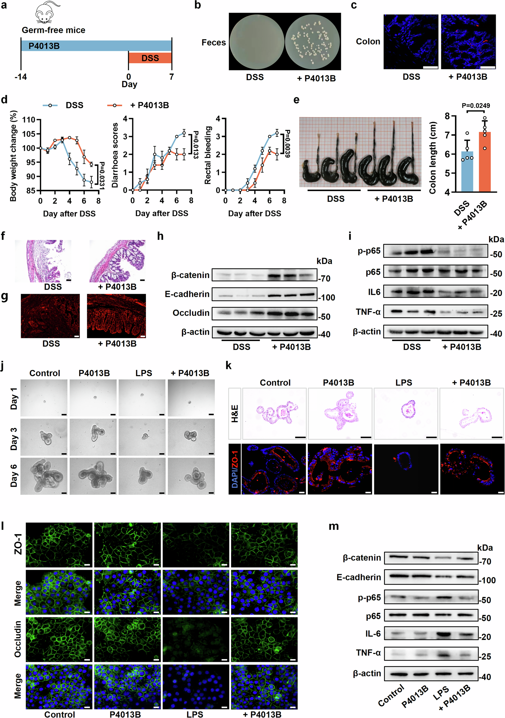 Fig. 2: P4013B attenuates colitis independent of inherent gut microbiota.