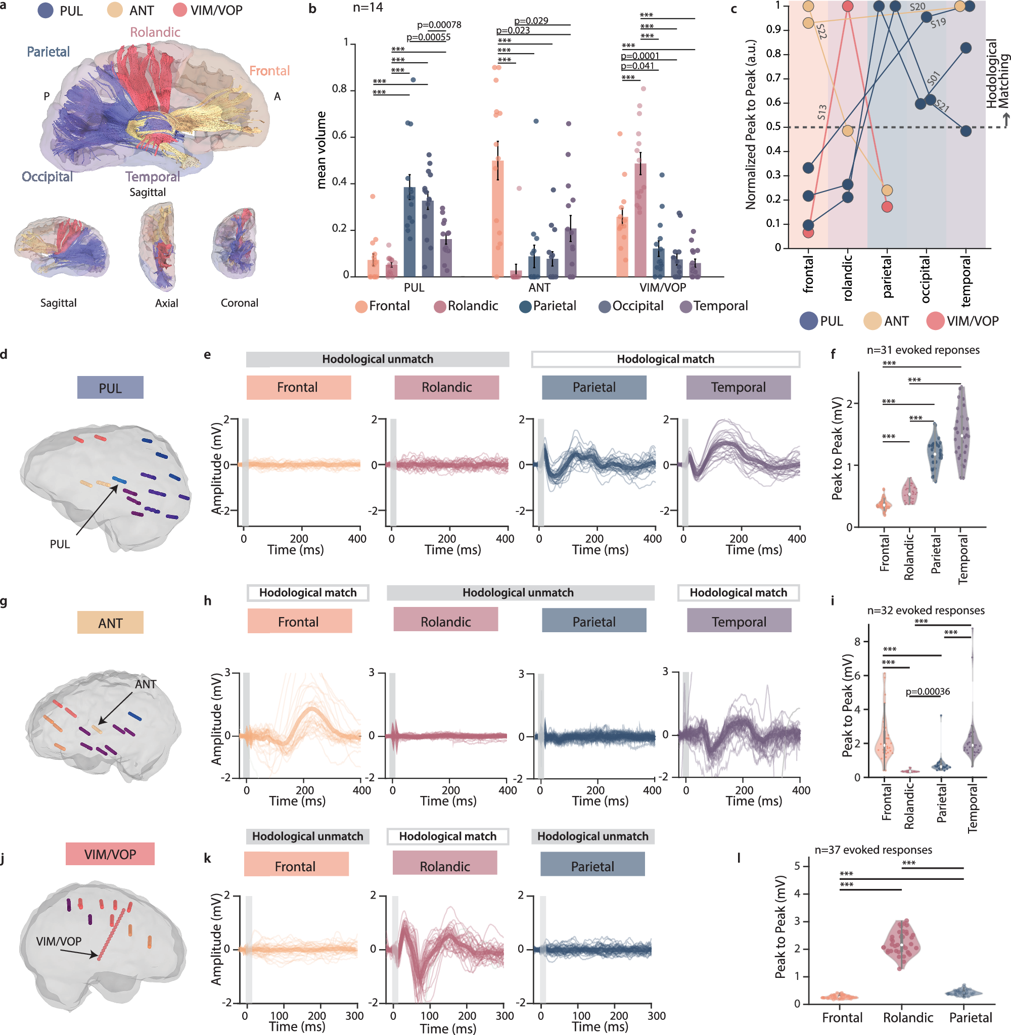 Fig. 2: Anatomical connectivity of PUL, ANT, and VIM/VOP via neuroimaging and electrophysiology.