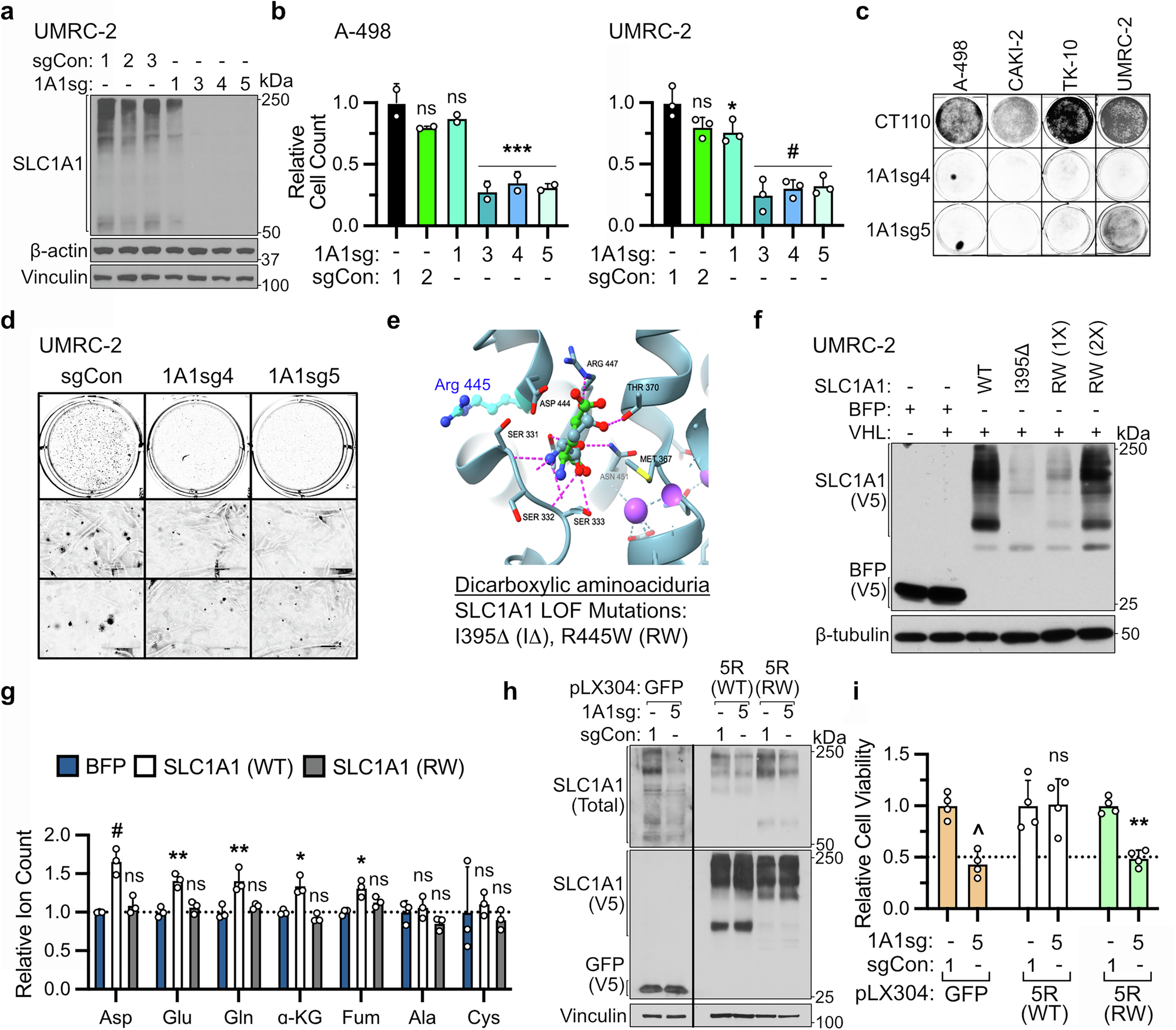 Fig. 4: SLC1A1’s metabolic function is necessary to support ccRCC growth.