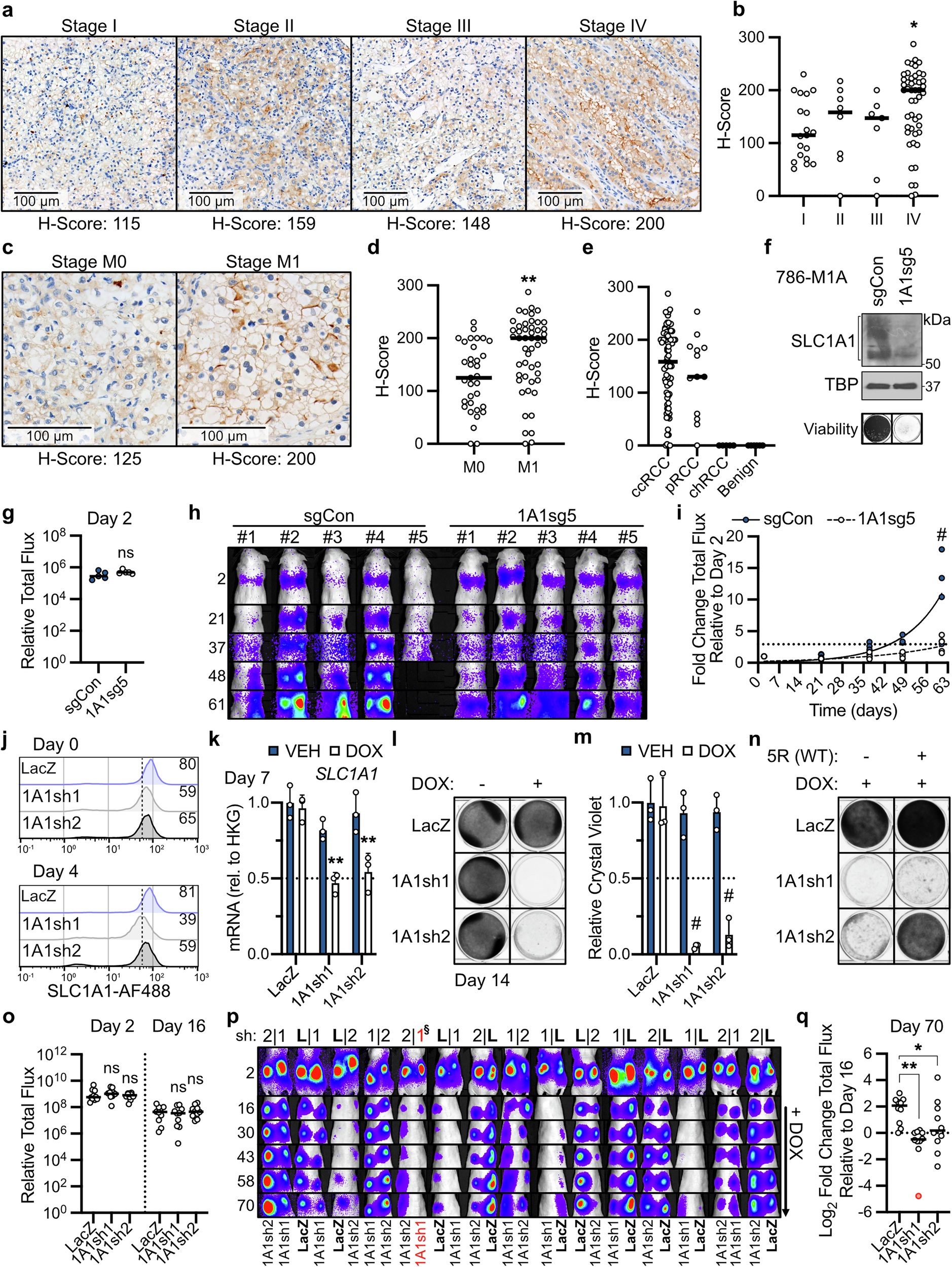 Fig. 8: SLC1A1 is necessary for ccRCC tumorigenesis and metastasis.