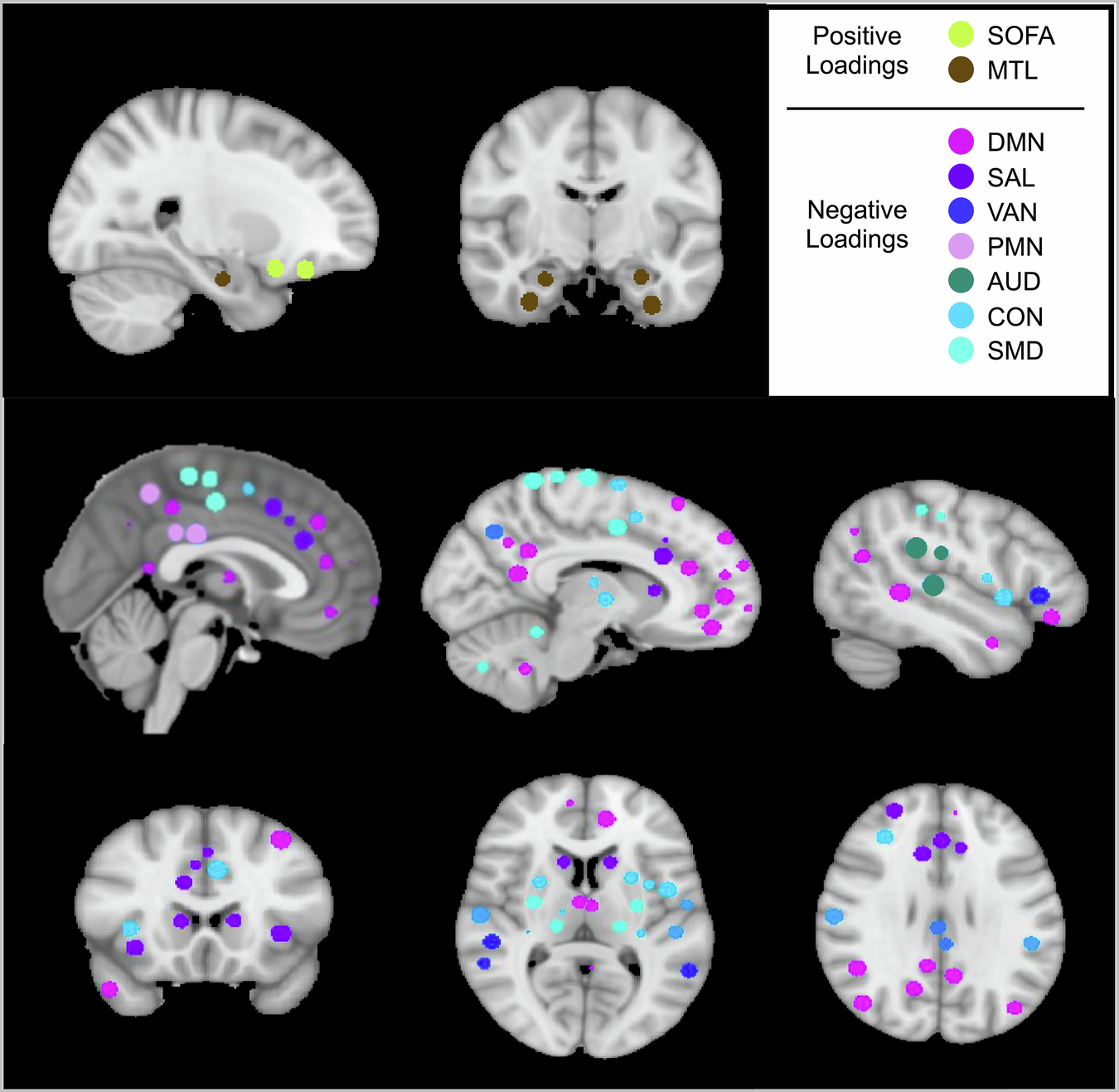 Fig. 2: Regions of interest in the networks with loadings onto the SOFA, MTL, SAL, PMN Network Connectivity Brain Signature.