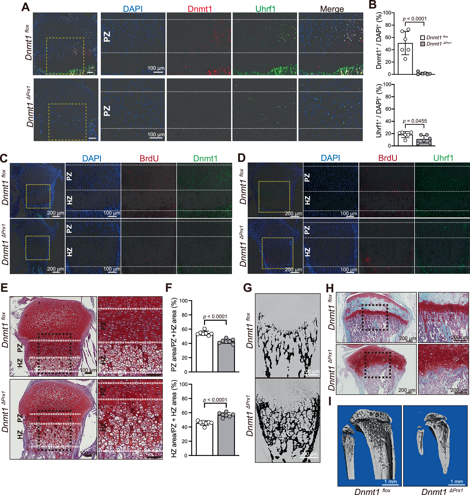 Fig. 2: Narrowed proliferative cartilage layer and promotion of chondrocyte hypertrophy and mineralization associated with Dnmt1 deficiency.