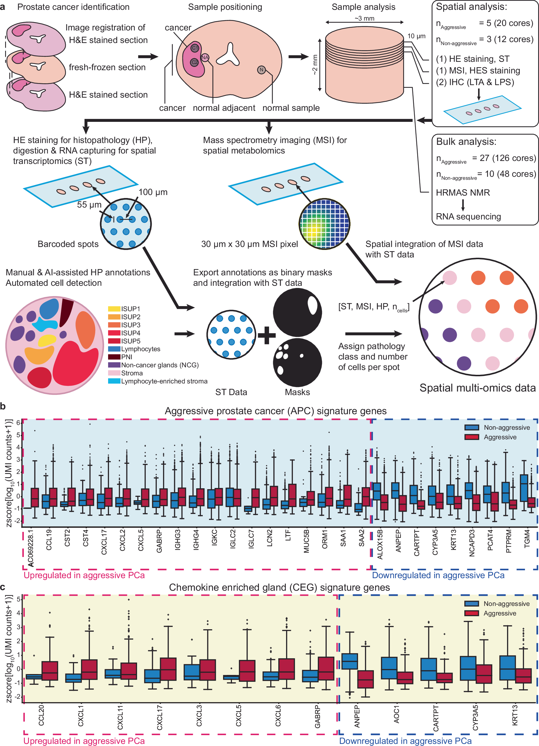 Fig. 1: Spatial multi-omics analysis of the prostate tumor microenvironment reveals gene signatures discriminating between aggressive and non-aggressive disease patient groups.