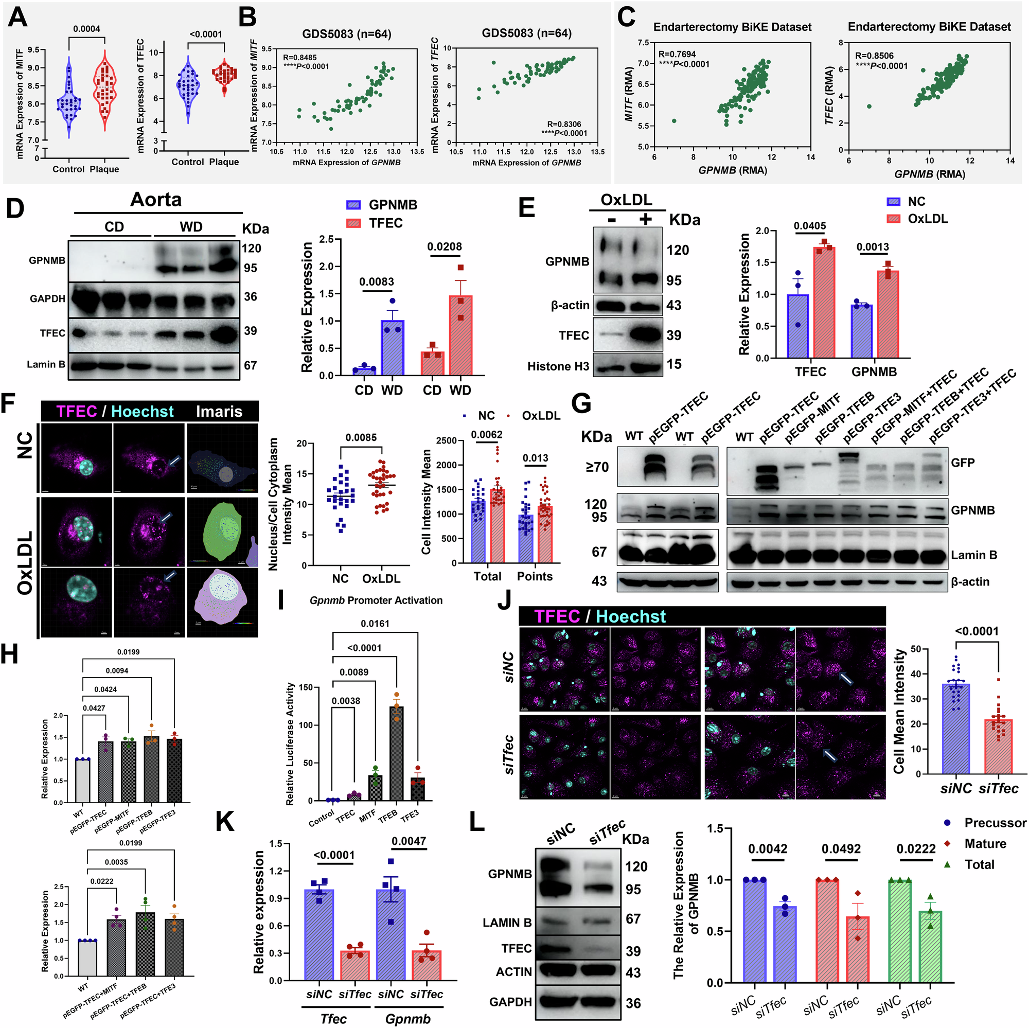 Fig. 3: TFEC induced Gpnmb expression in macrophages during atherosclerosis progression.