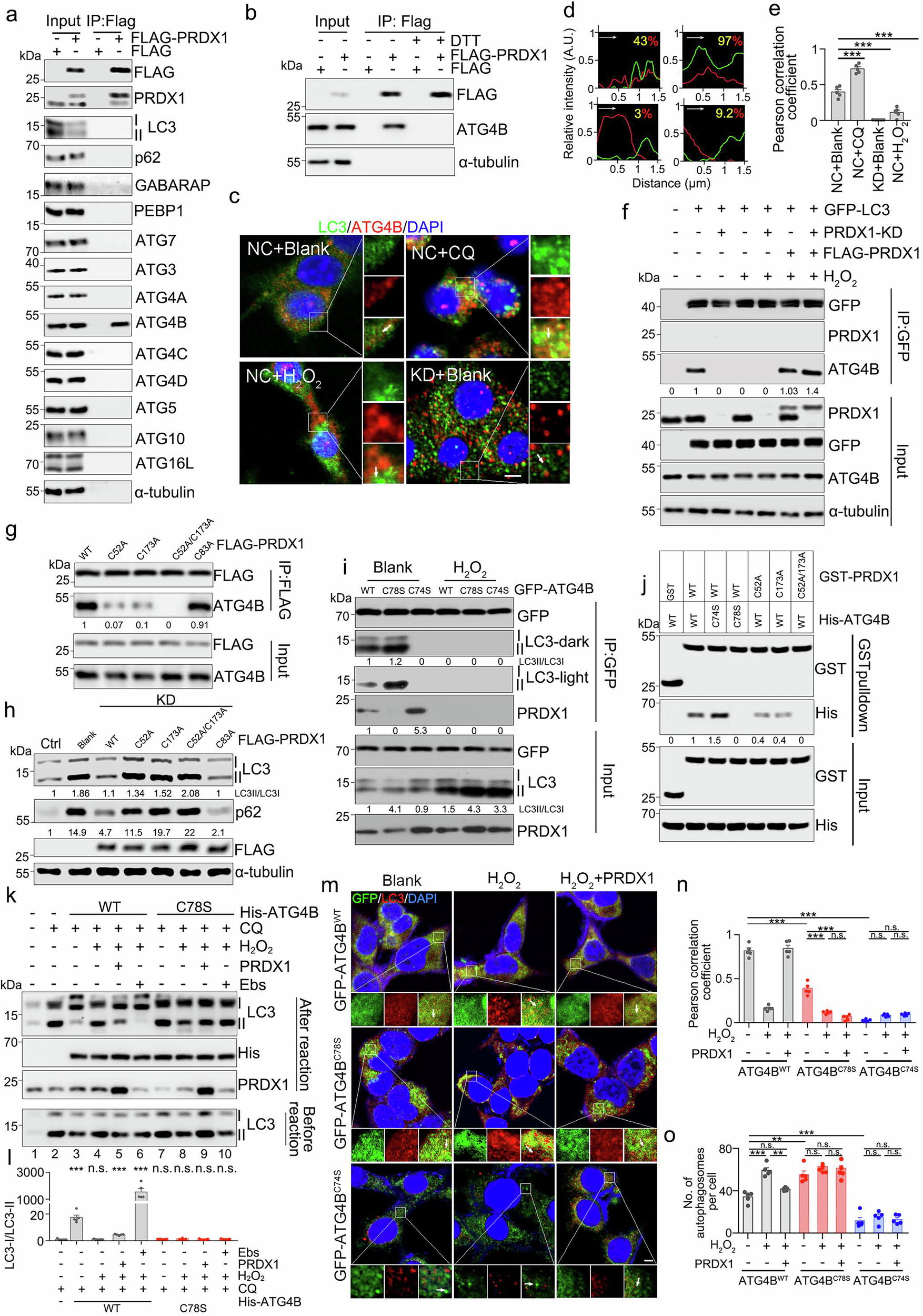 Fig. 6: PRDX1 controls autophagy by modulating LC3 delipidation through redox-dependent regulation of ATG4B.