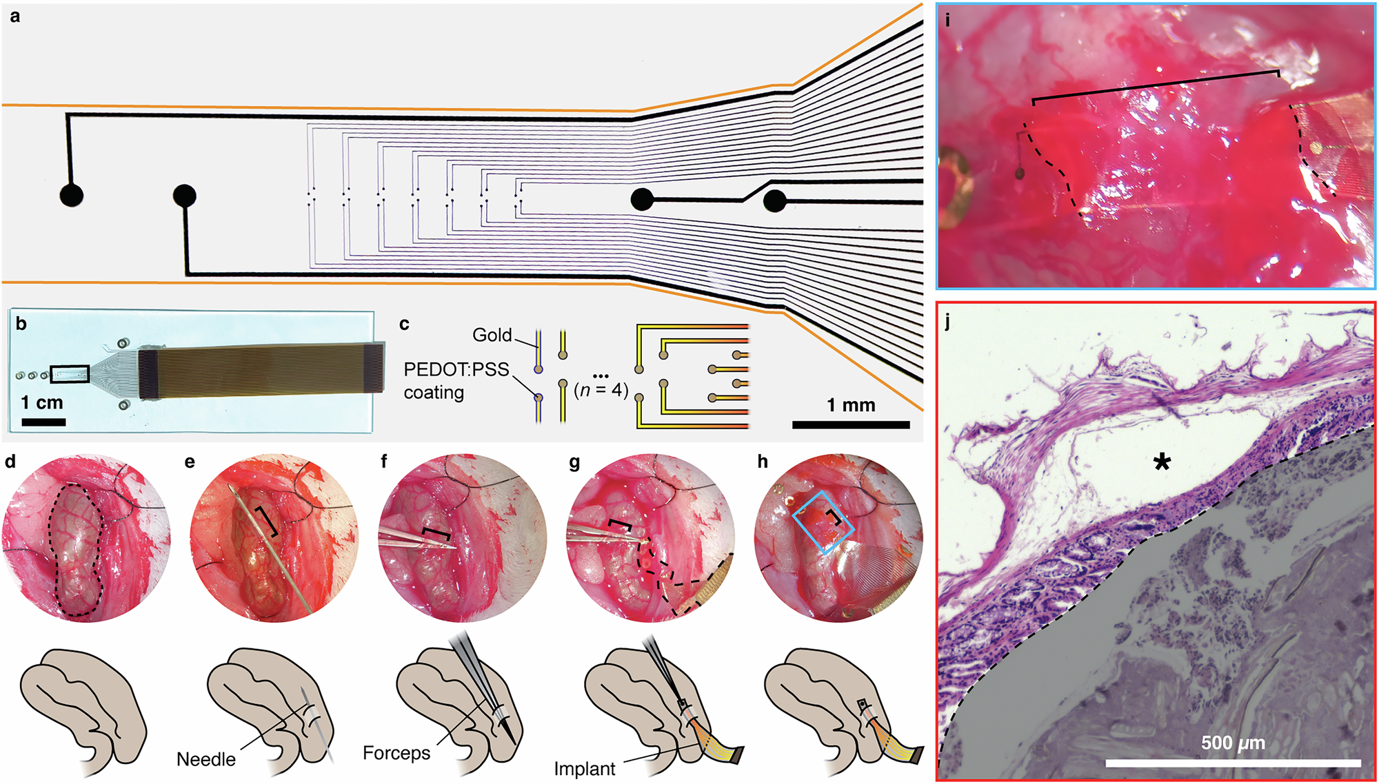 Fig. 1: Conformable devices can be surgically implanted on top of the submucosal plexus of the colon.