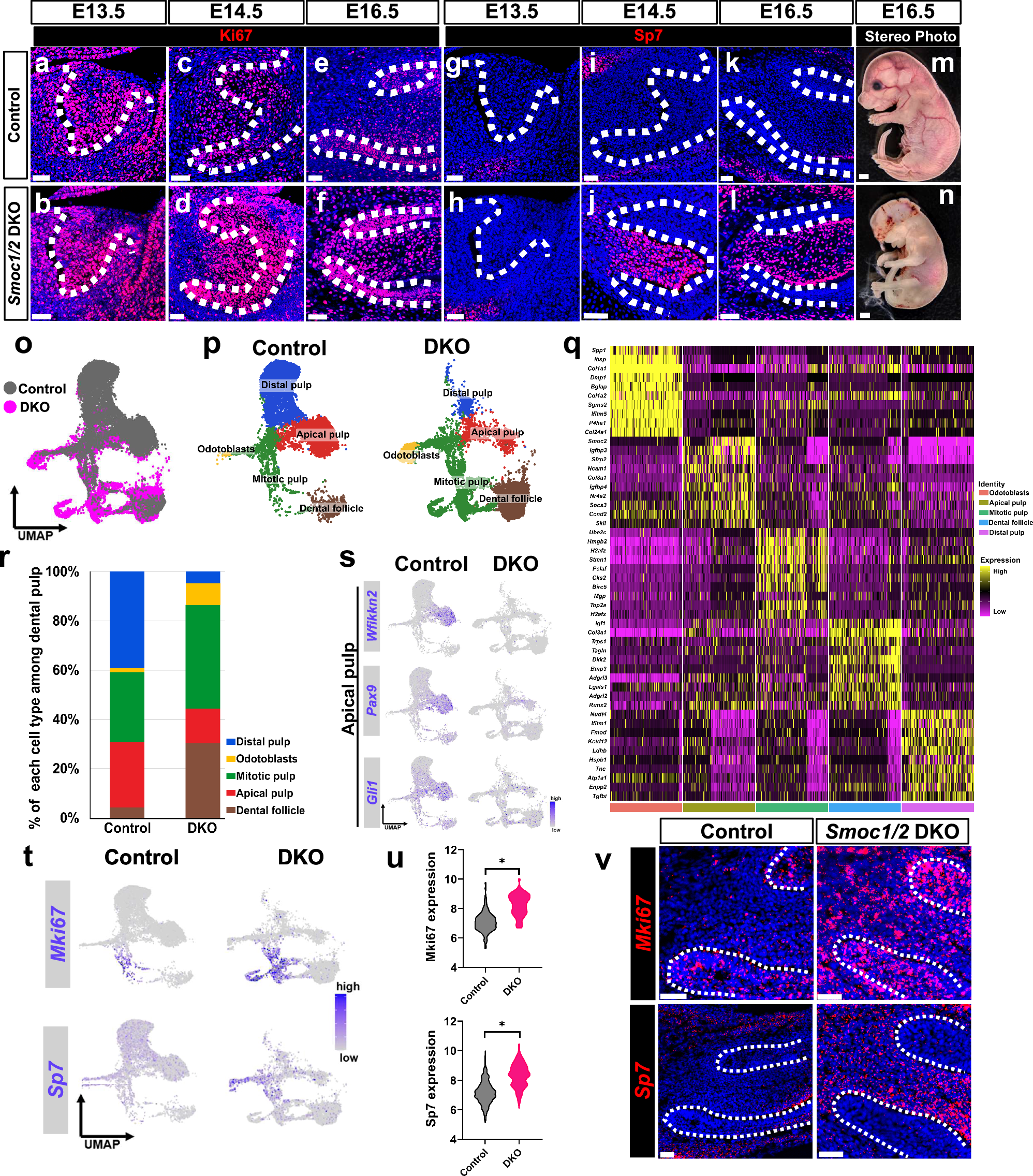 Fig. 5: Loss of Smoc1/2 leads to quiescence loss and mesenchymal hierarchy disruption.