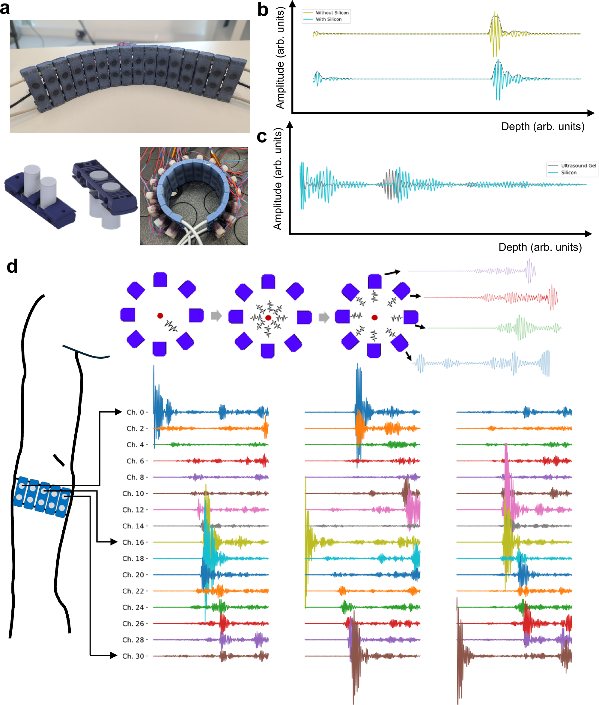 Fig. 1: A-mode 32 channel dry-coupling ultrasound bracelet.