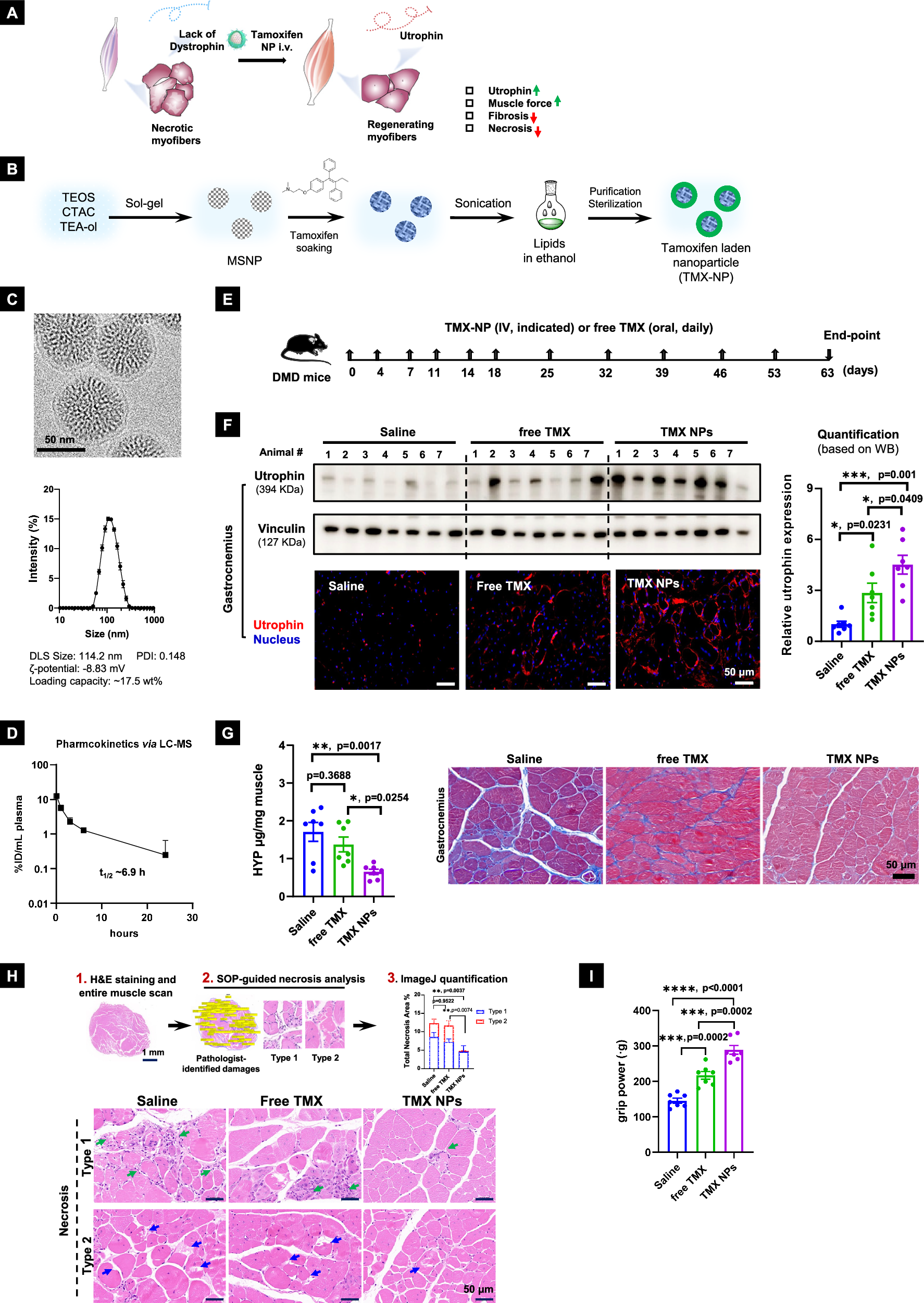 Fig. 4: Systemic administration of TMX NPs led to potent efficacy in a DMD mouse model.