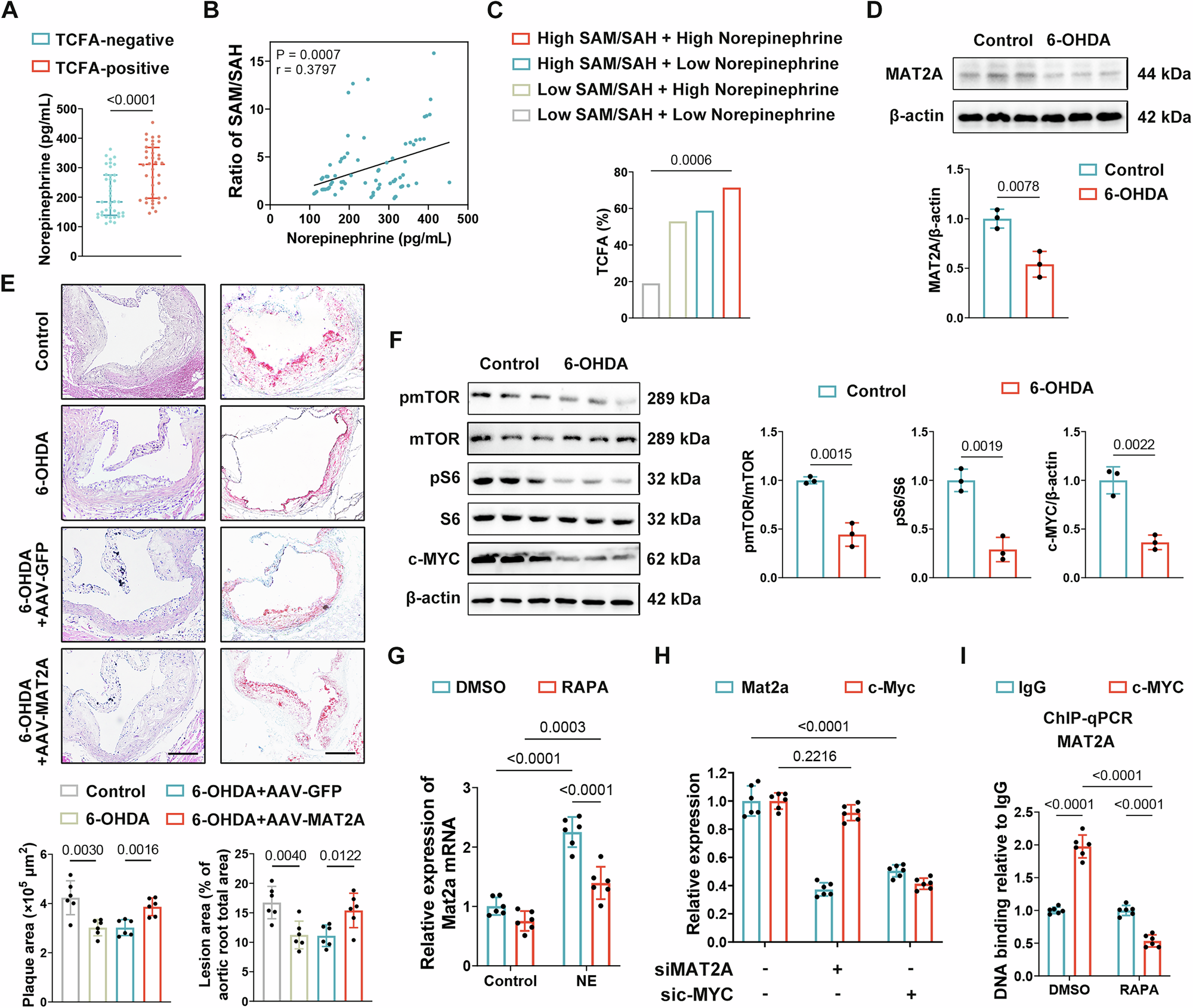 Fig. 6: Norepinephrine regulates MAT2A expression in atherosclerosis progression via the mTOR-c-MYC axis.