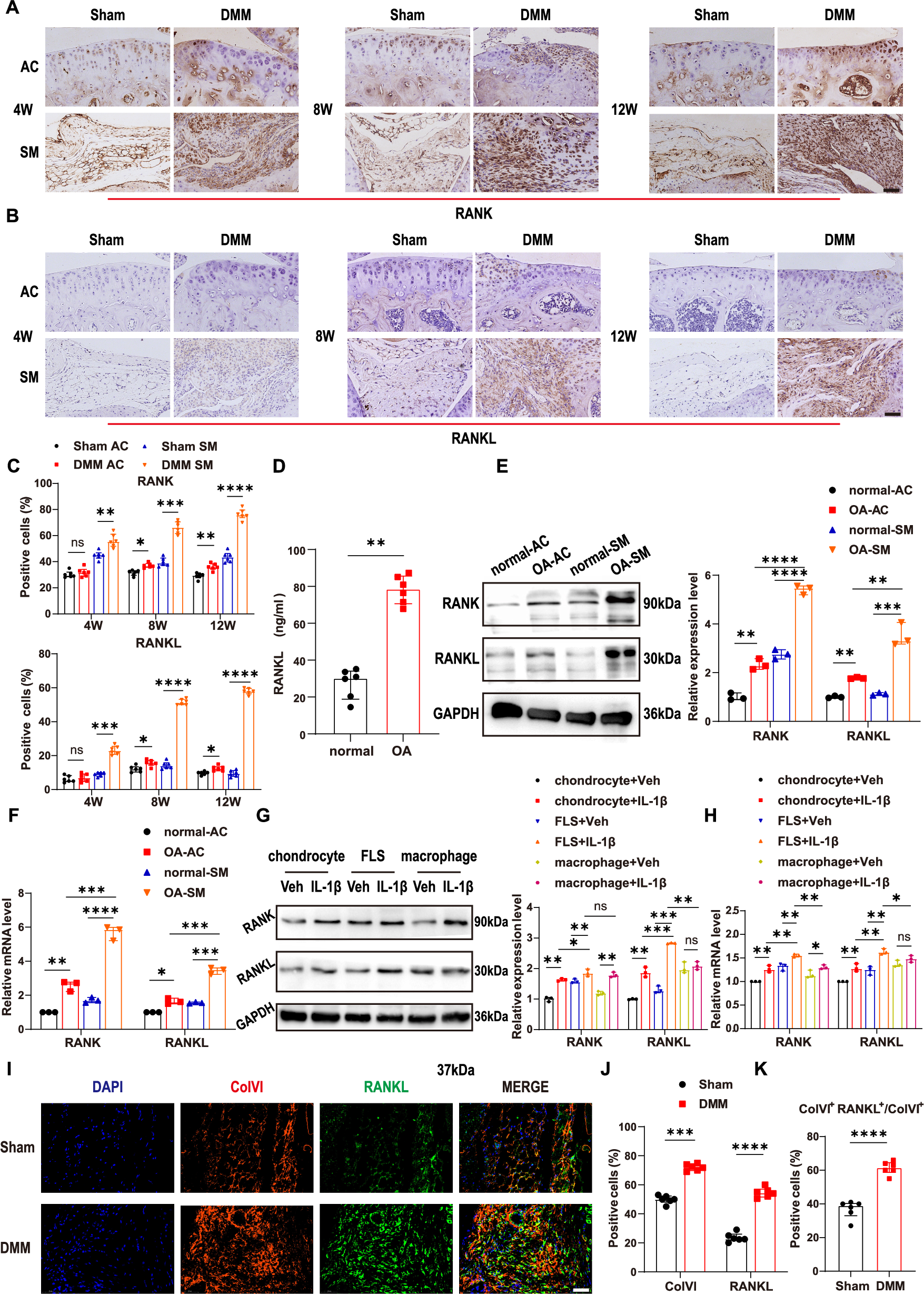 Fig. 1: Expression levels of RANK and RANKL in cartilage and synovium.