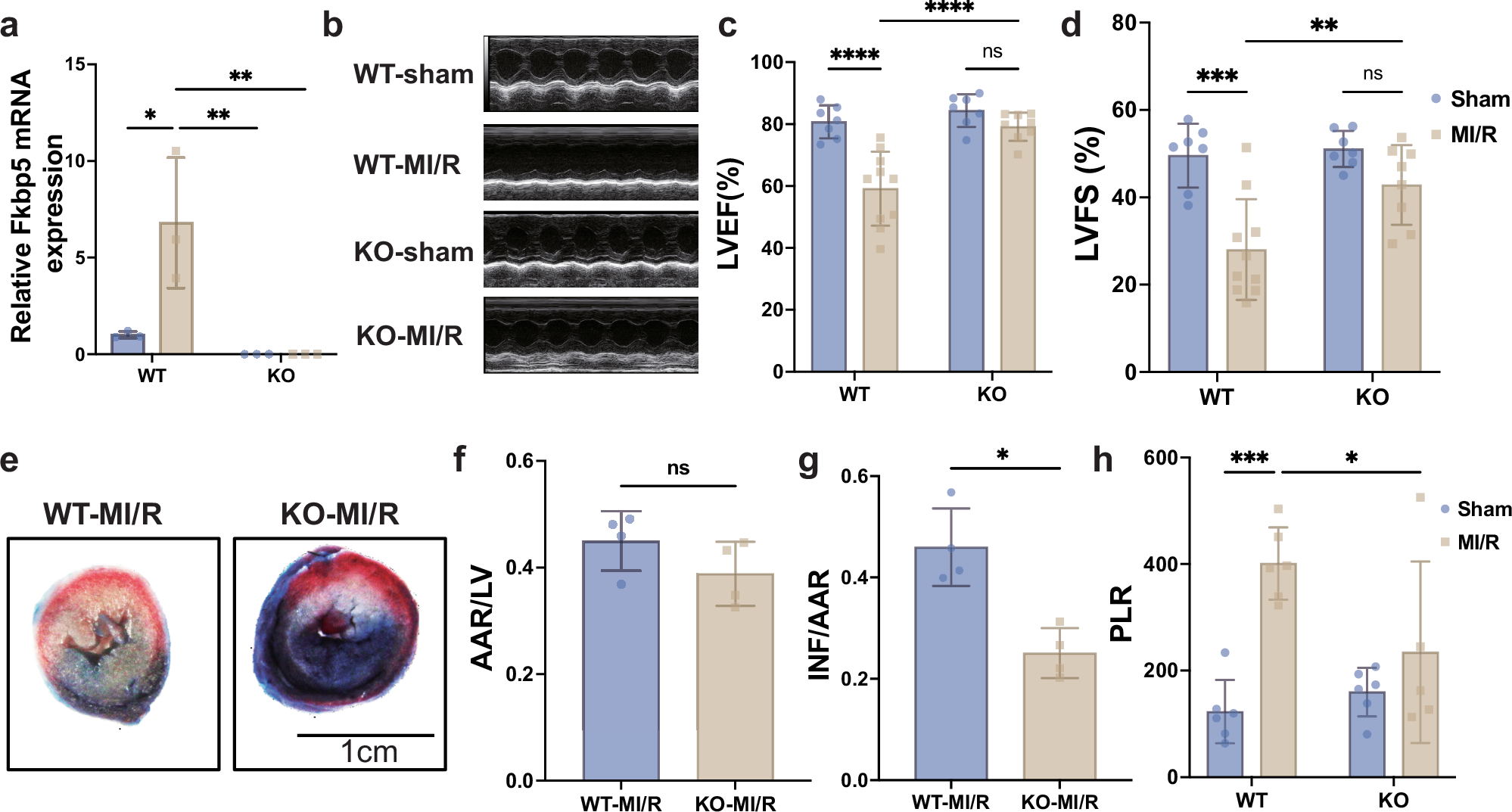 Fig. 4: Downregulation of Fkbp5 improves left ventricular functions.