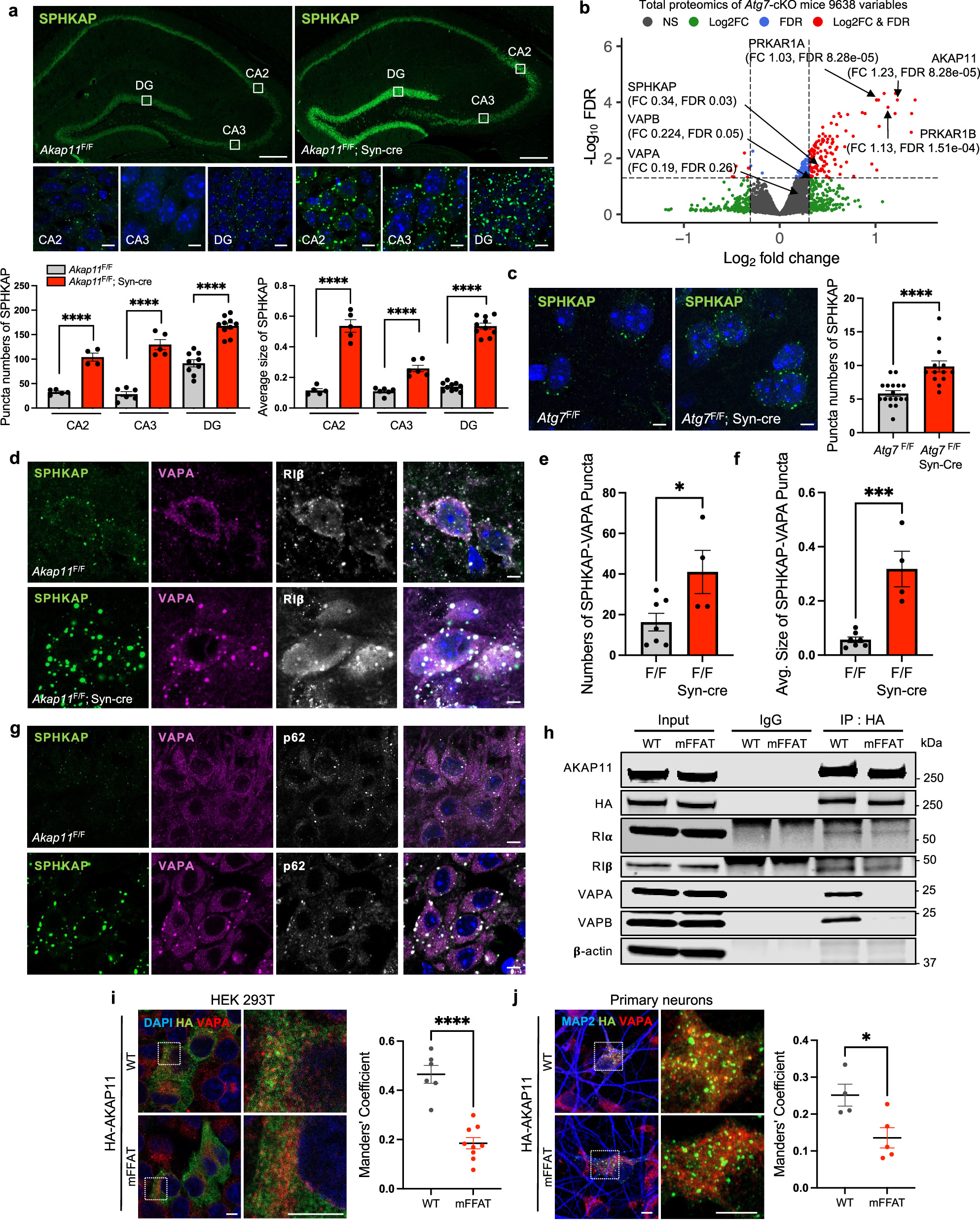 Fig. 6: Characterization of SPHKAP and VAP proteins in neurons from Akap11-cKO and Atg7-cKO mouse brains.