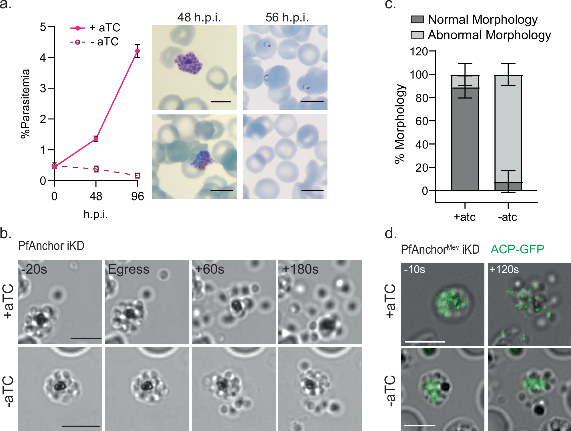 Fig. 3: PfAnchor is required for the release of segregated merozoites but dispensable for egress.