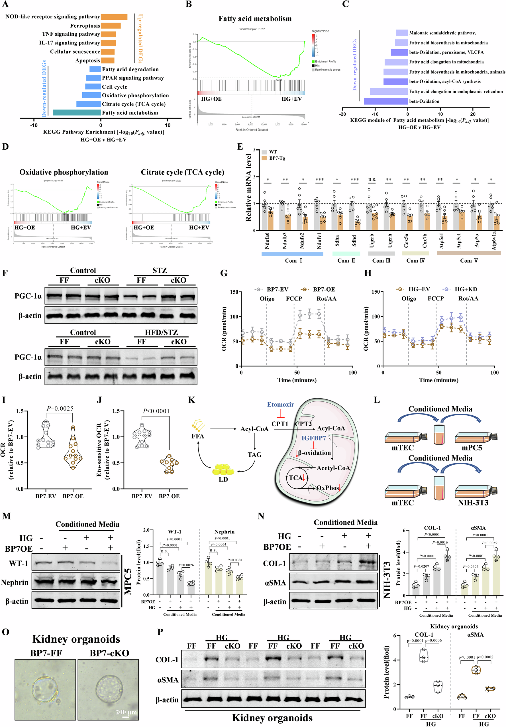 Fig. 3: Tubule-derived IGFBP7 induces impaired FA degradation, glomerular dysfunction, and fibrosis.