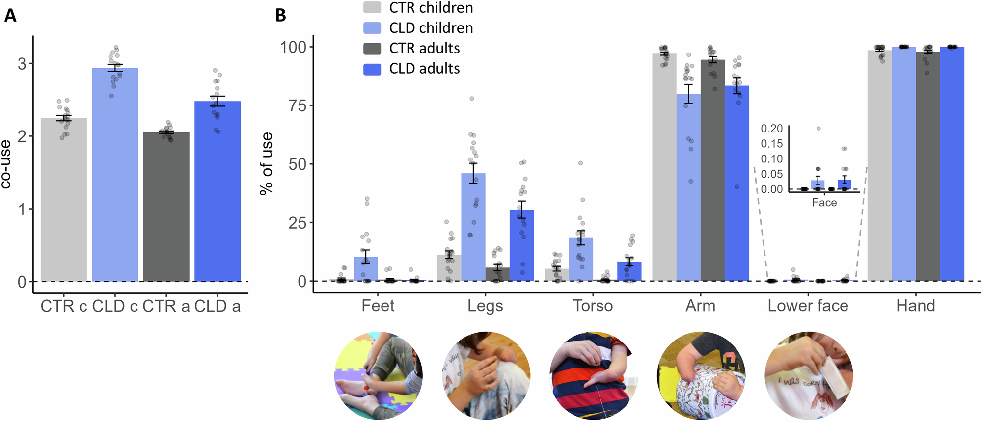 驚異的な適応力を持つ脳（The incredible, adaptable brain）