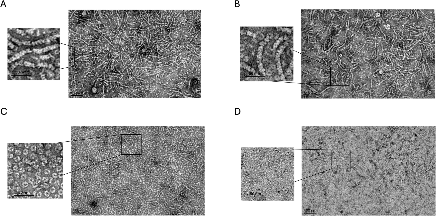 Fig. 2: Negative staining TEM images of RAD51 fibrils/oligomers in the presence and in the absence of Apt1.