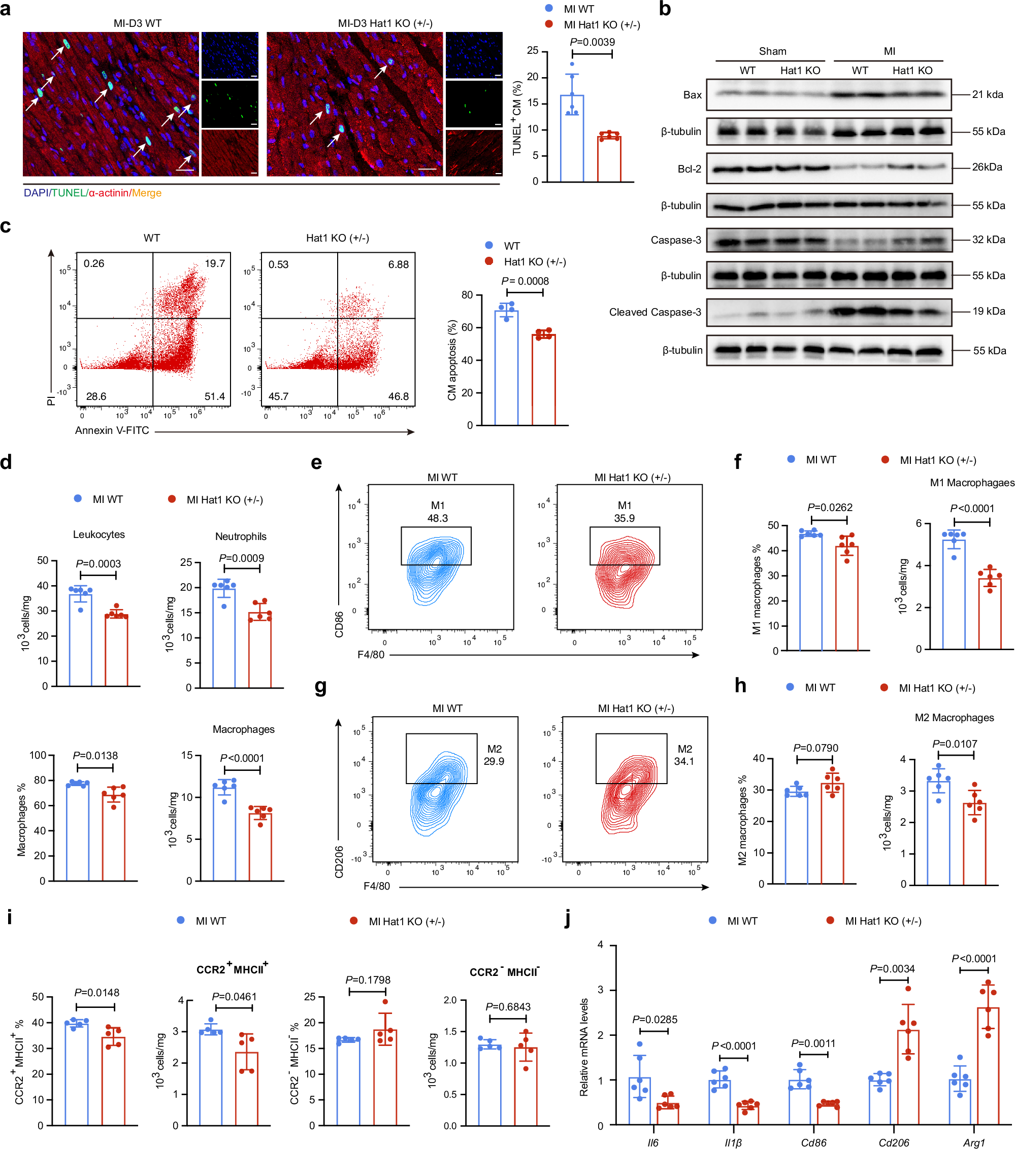Fig. 5: Loss of Hat1 attenuates cardiomyocyte apoptosis and suppresses macrophage-mediated inflammation in the myocardial infarction (MI) tissue.