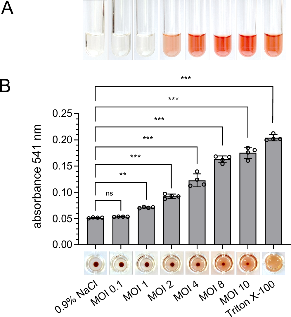 熱帯病オロヤ熱の疾患機構を解明、新たな治療法の可能性を提示(Tropical Disease Oroya Fever: Elucidation of Disease Mechanism