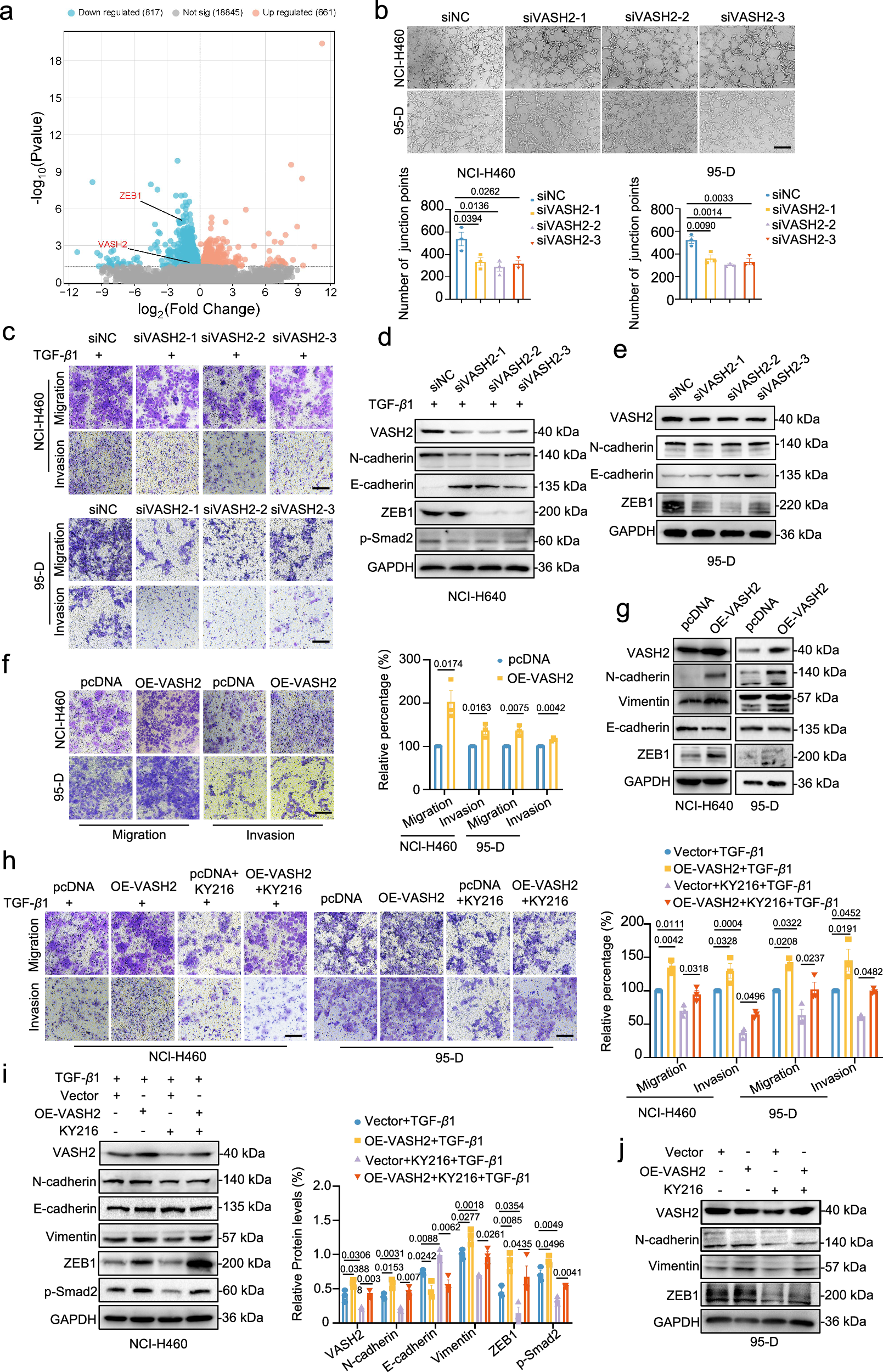 Fig. 4: KY216 inhibits EMT by reducing VASH2.