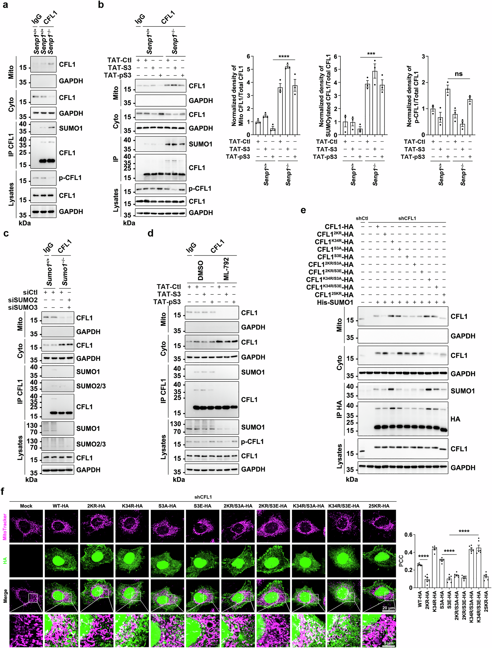Fig. 2: SUMOylation, rather than phosphorylation, determines the mitochondrial translocation of CFL1.