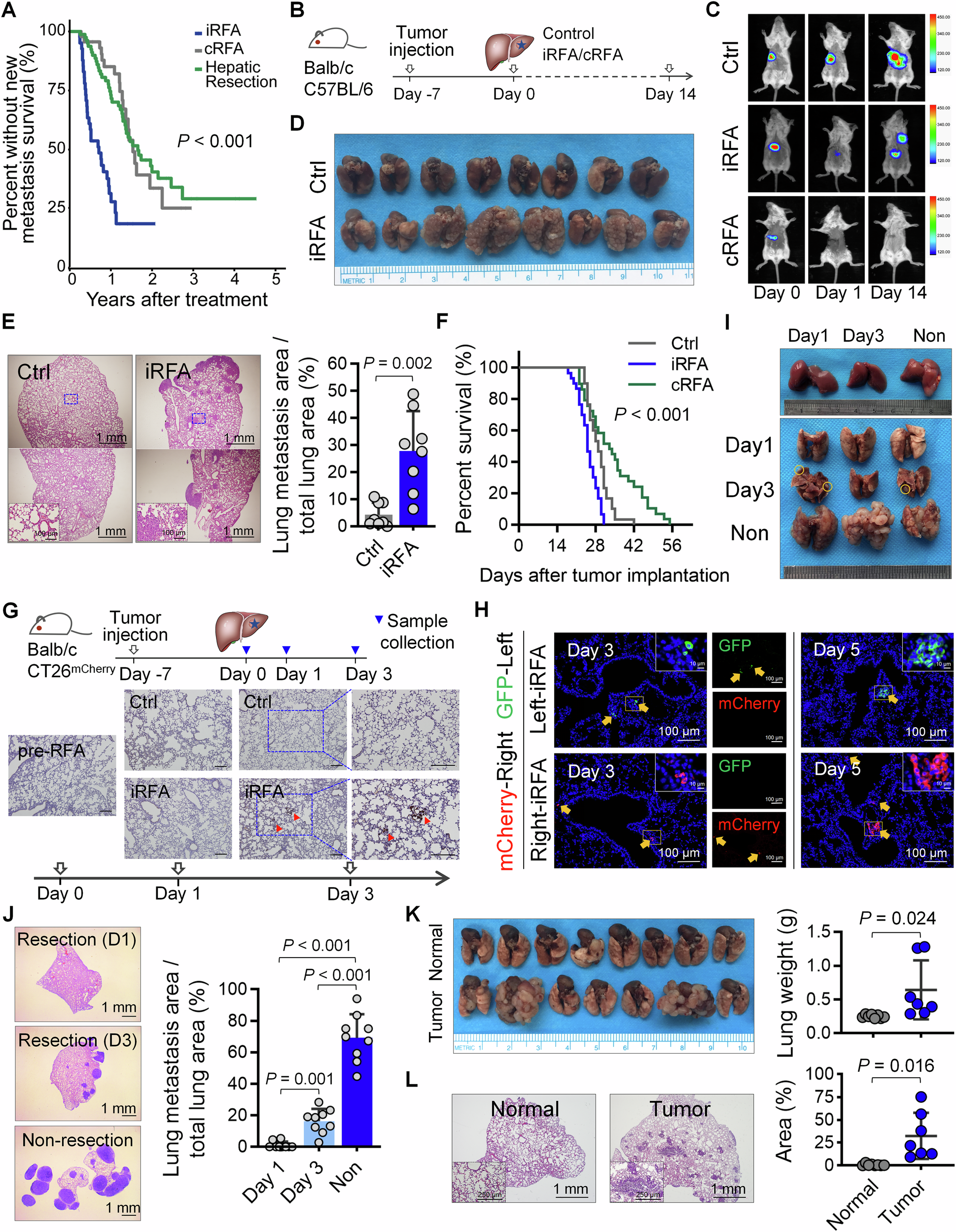 Fig. 1: iRFA promotes CRLM lung metastasis.