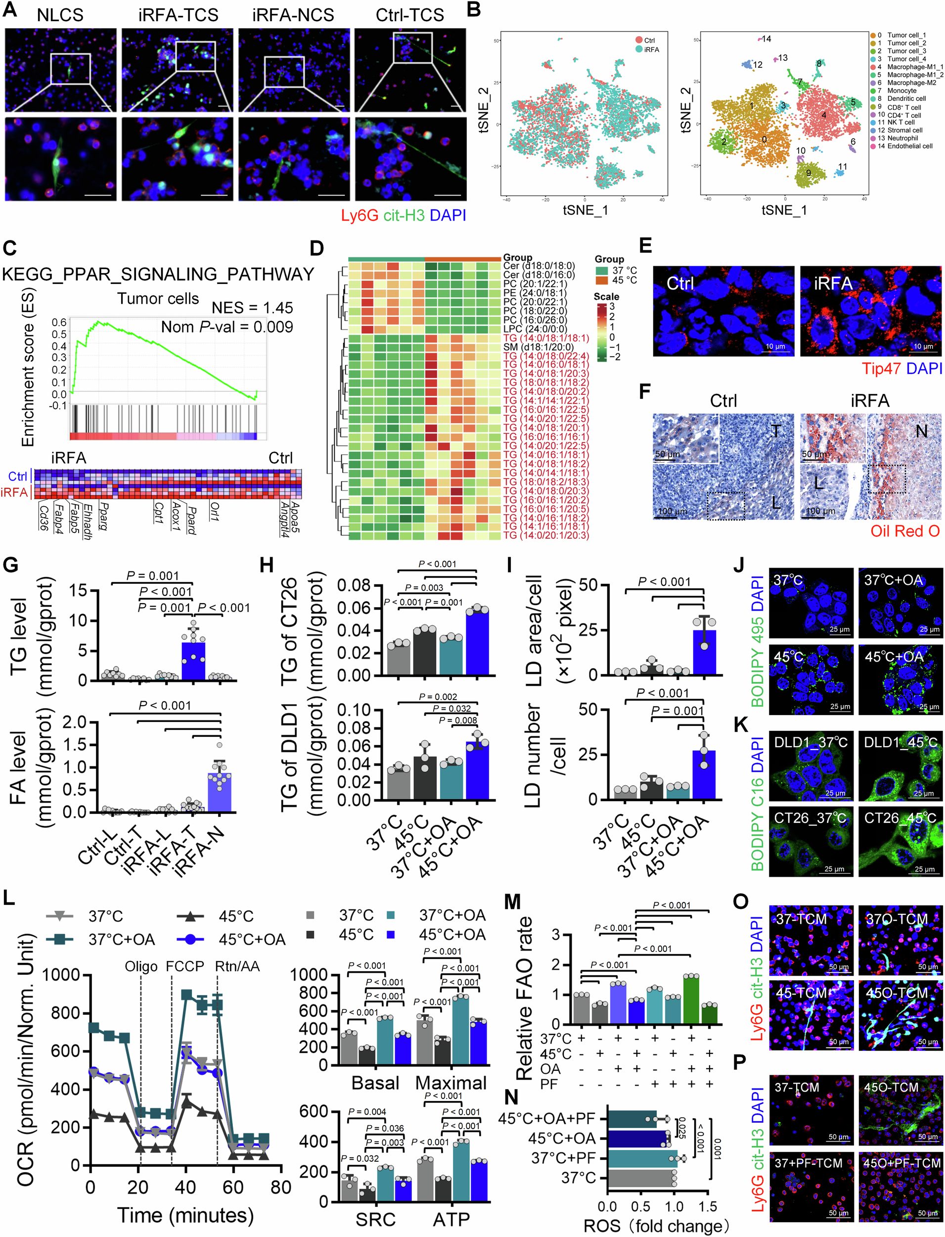 Fig. 4: iRFA induces TG accumulation and FAO homeostasis in residual tumor cells.