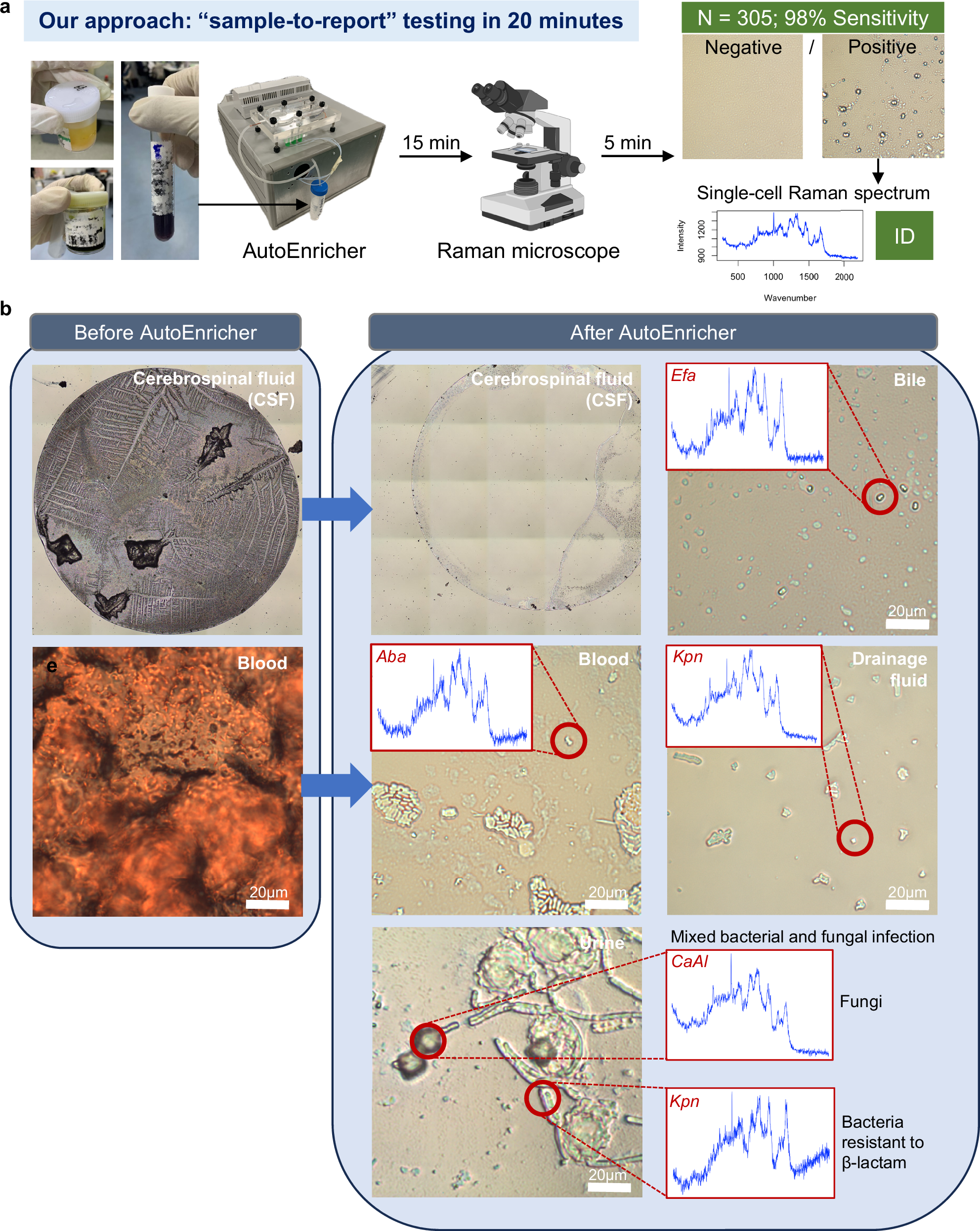 Fig. 7: Rapid clinical pathogen identification using the enrichment system and Raman microscopy.