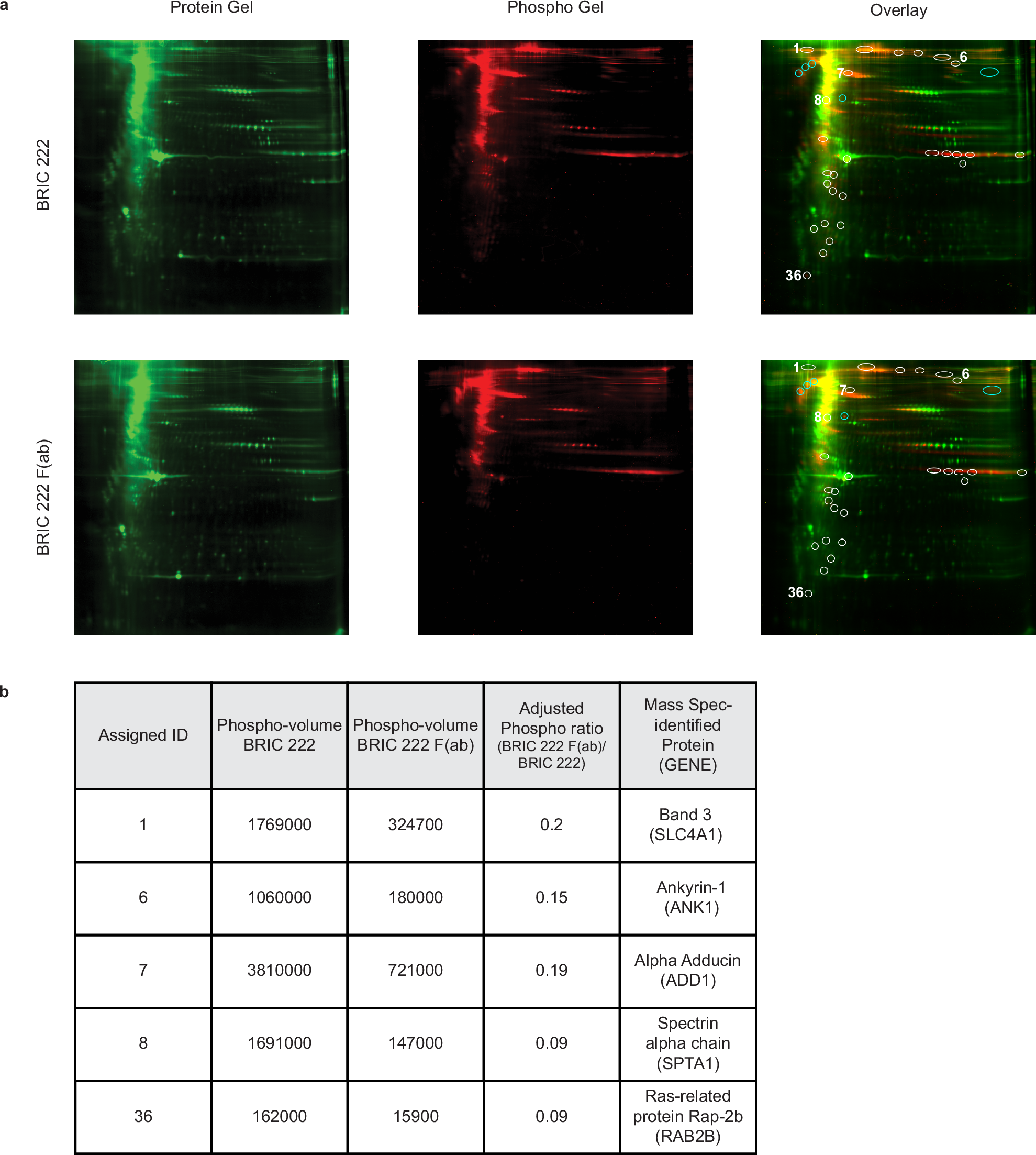 Fig. 3: CD44 cross-linking induces phosphorylation of RBC cytoskeletal proteins.