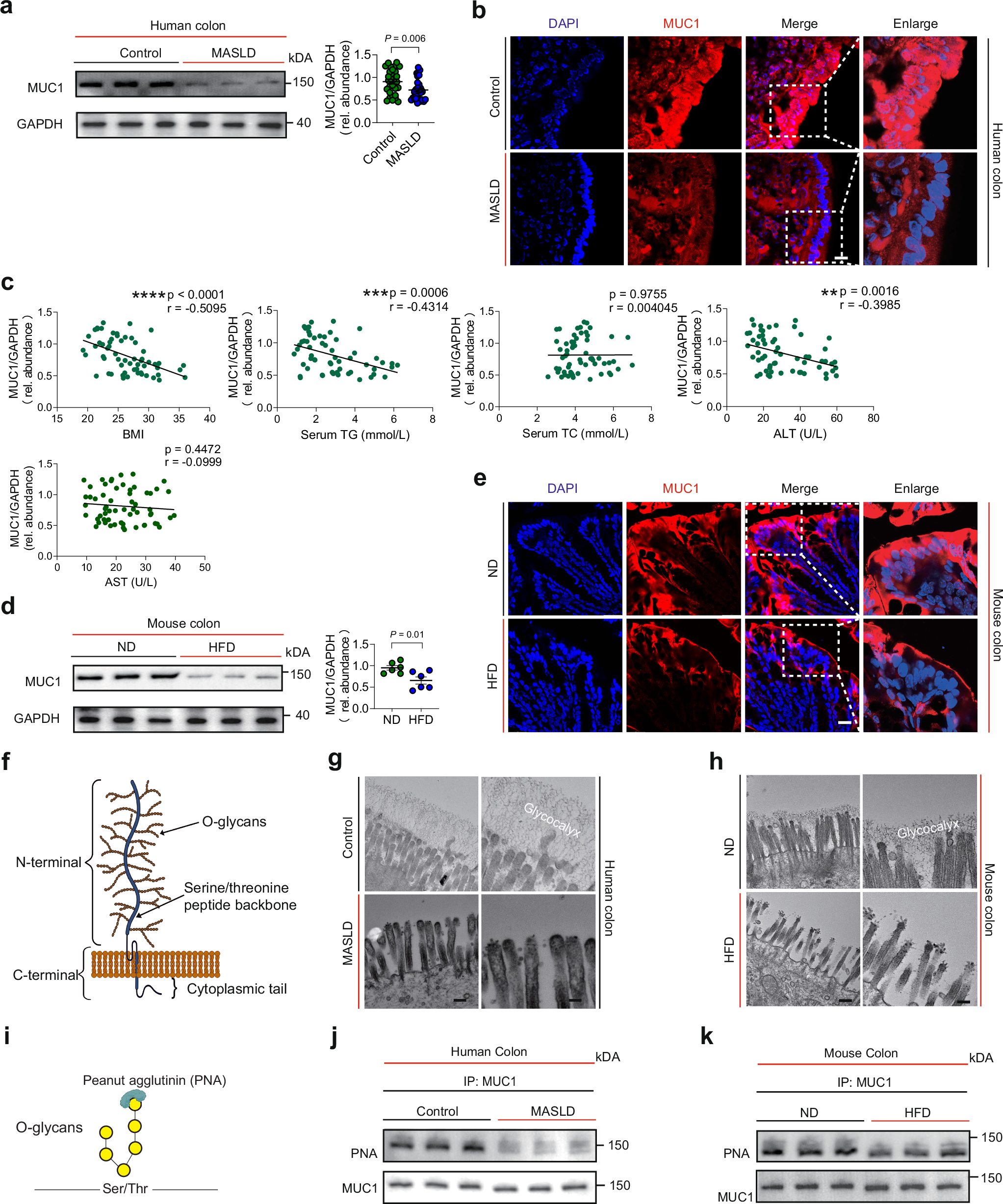 Fig. 1: Intestinal MUC1 protein levels and glycosylation are reduced in humans and mice with MASLD.