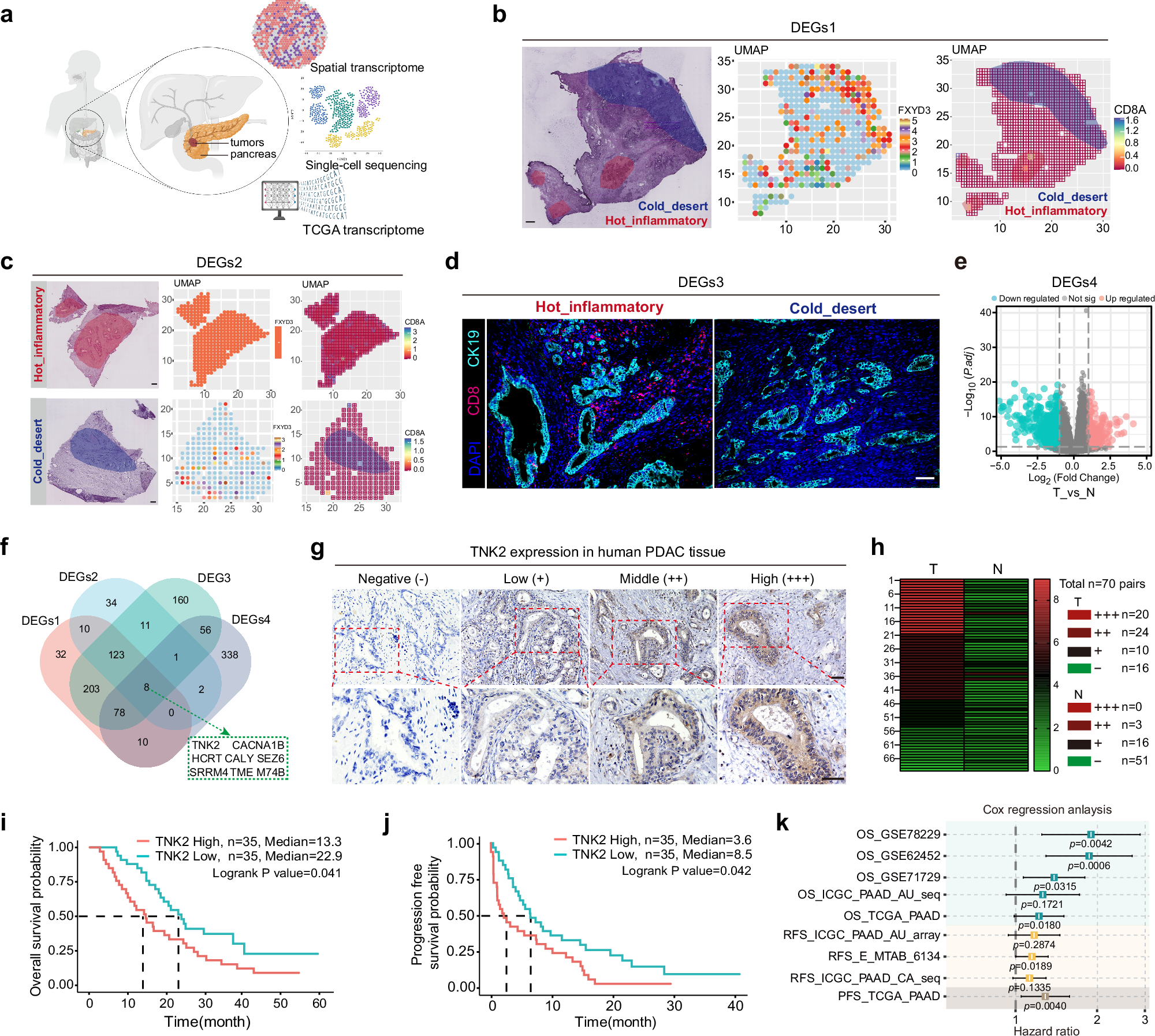 Fig. 1: TNK2 expression negatively correlates with immune infiltration and prognosis in PDAC.