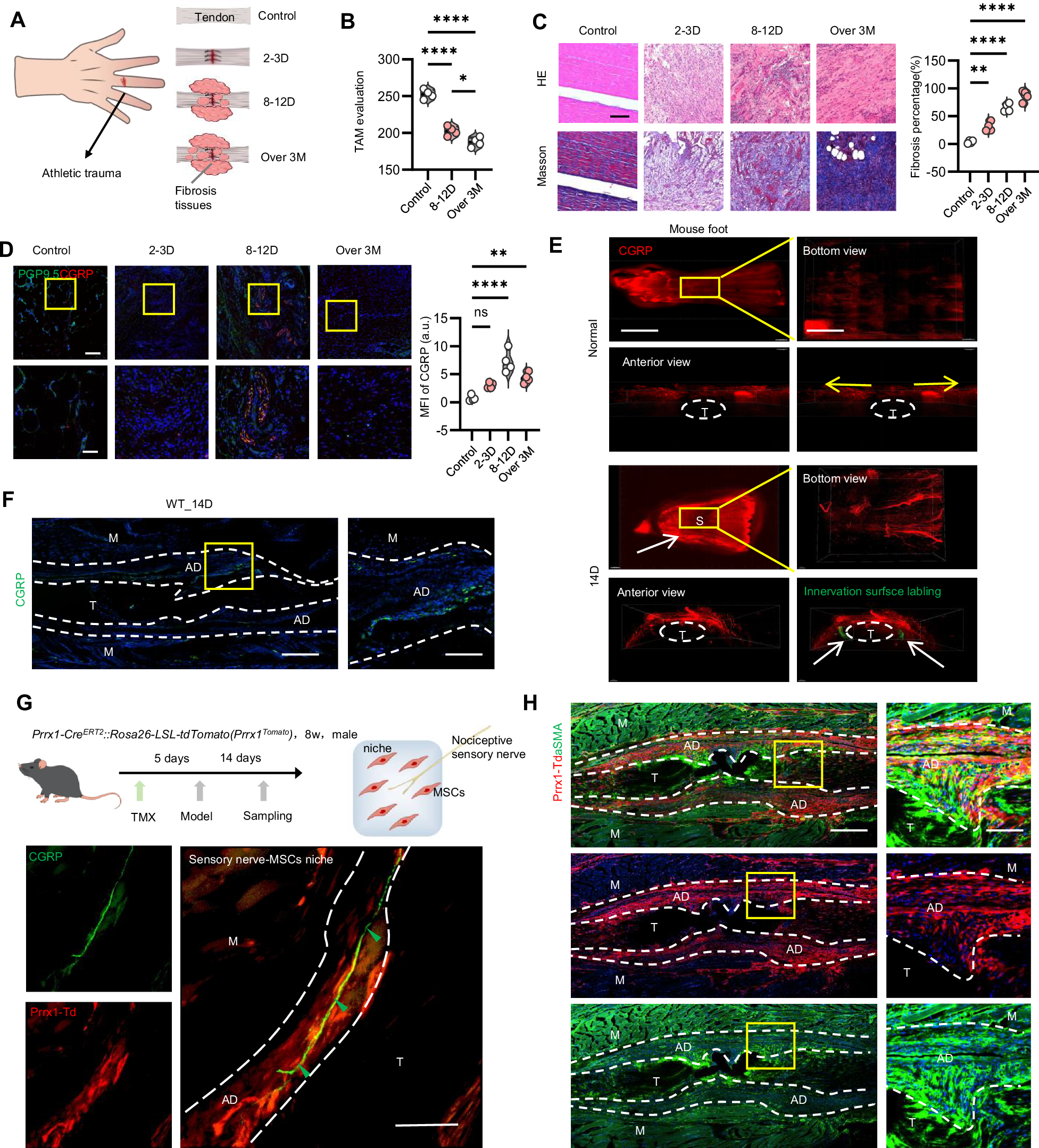 Fig. 1: Nociceptive sensory nerve innervation after peripheral trauma with fibrogenesis in the fibrotic niche.