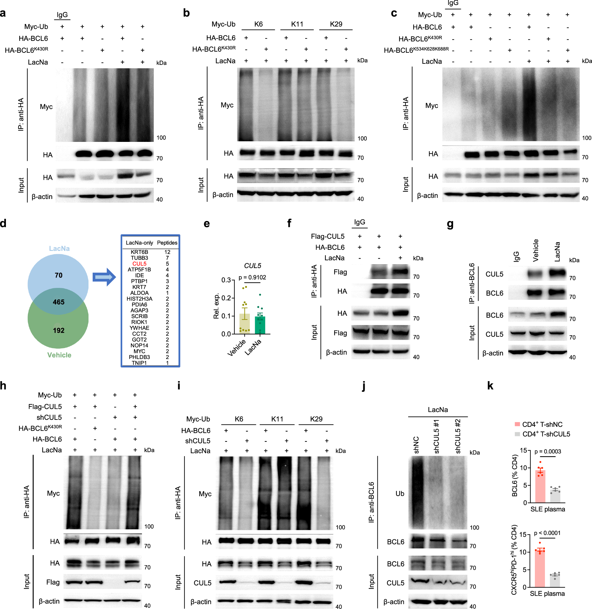 Fig. 5: CUL5 catalyzes K6- and K29-linked ubiquitination at Lys430 and attenuates BCL6 degradation.