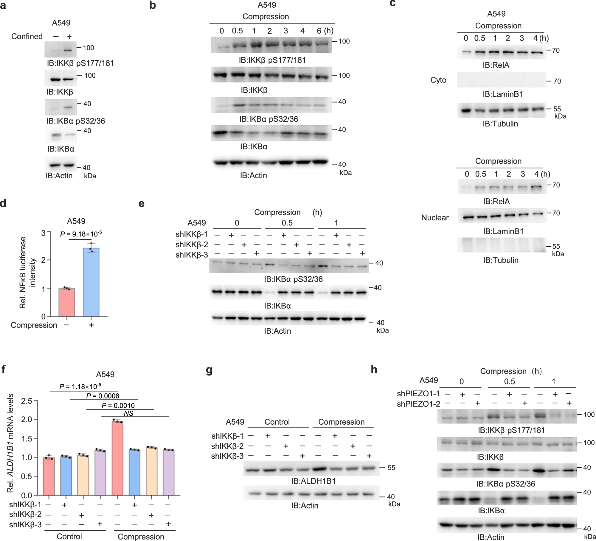 Fig. 5: Compressive force activates IKKβ and NF-κB via PIEZO1.