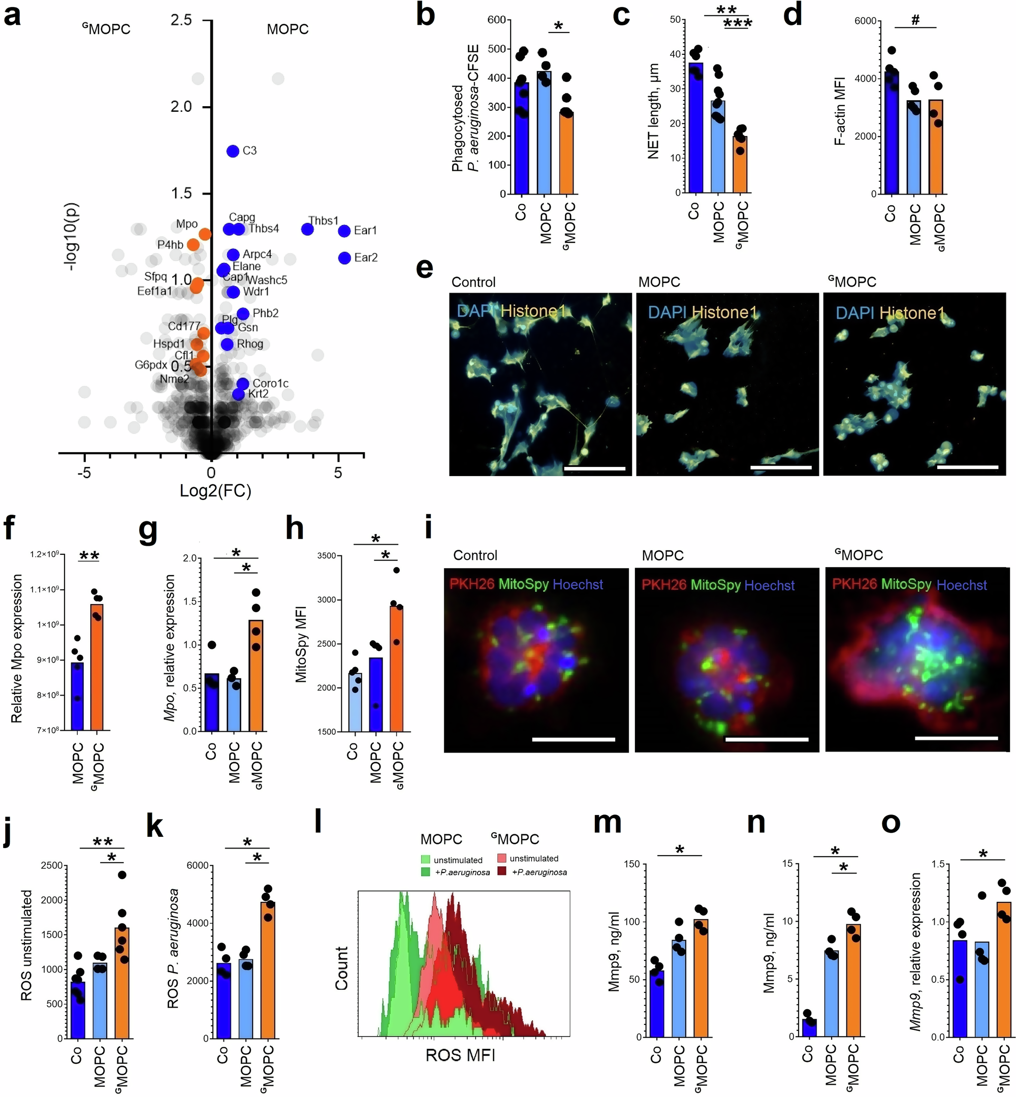 Fig. 3: Chronic exposure to tumor-derived G-CSF impairs bactericidal activity and increases tissue toxicity of Gneutrophils.