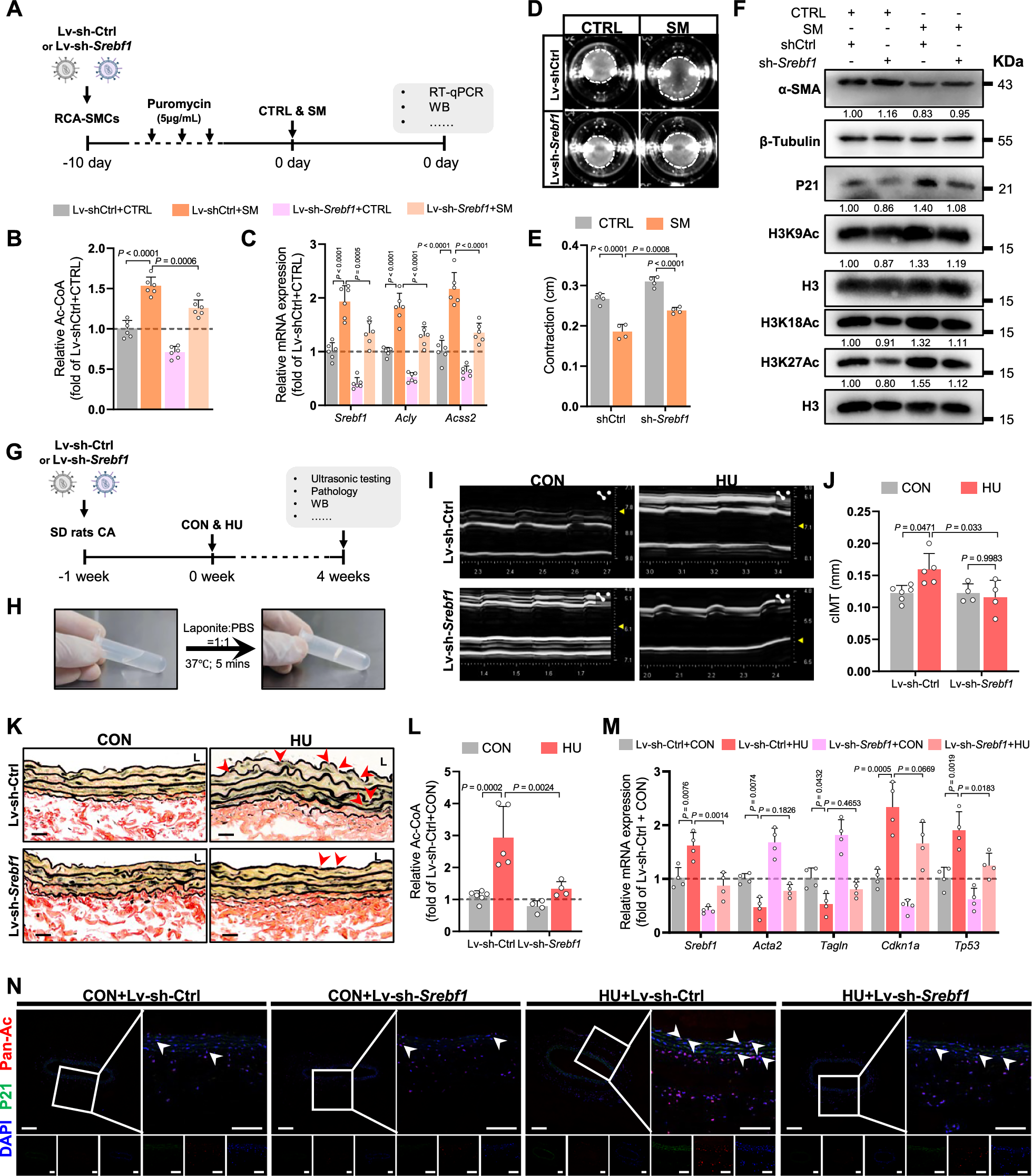 Fig. 7: Knockdown of Srebf1 alleviates senescence-like transformation of VSMC induced by simulated microgravity.