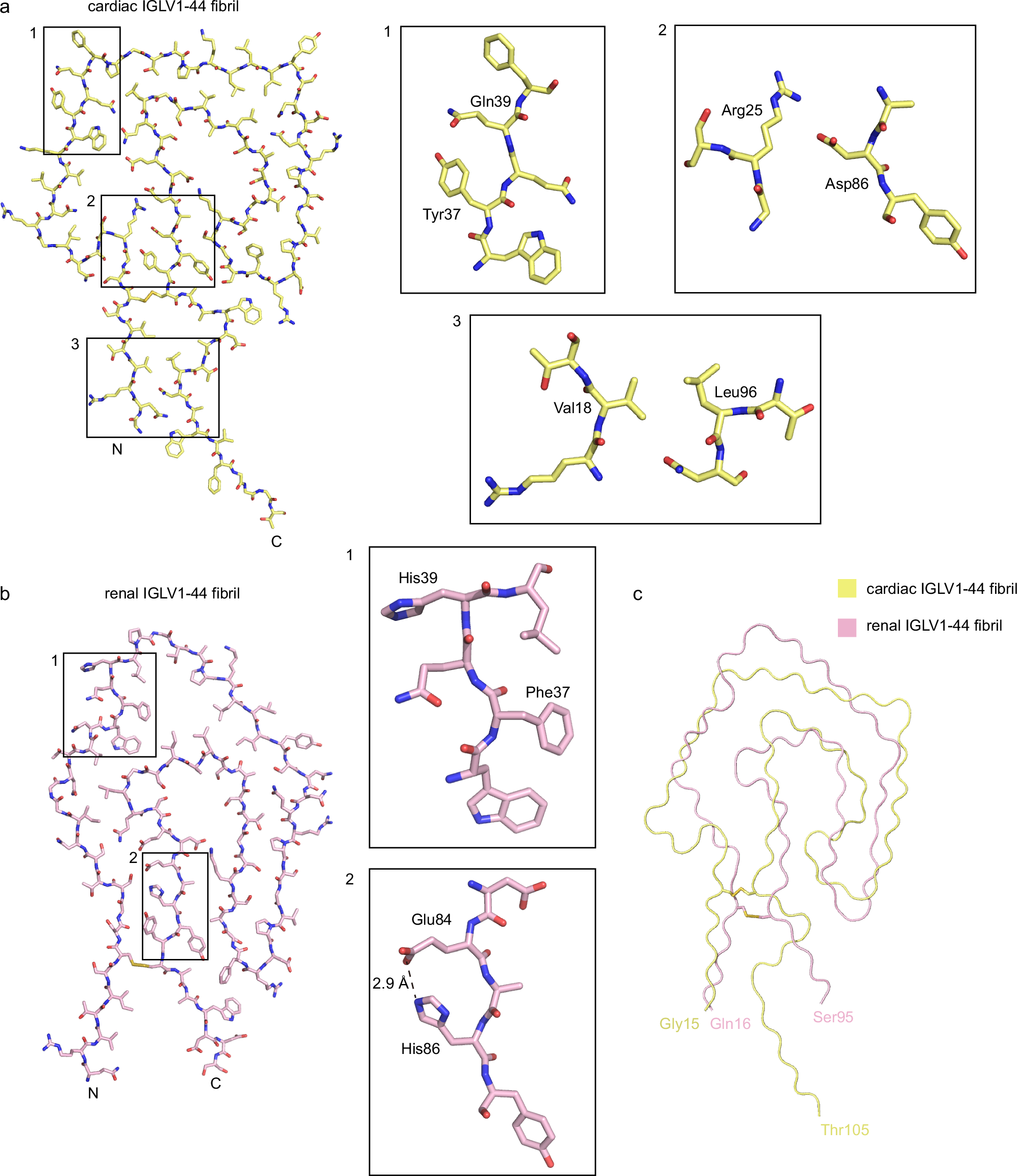Fig. 4: Comparison of the cryo-EM structures of cardiac IGLV1-44 fibril and renal IGLV1-44 fibril.