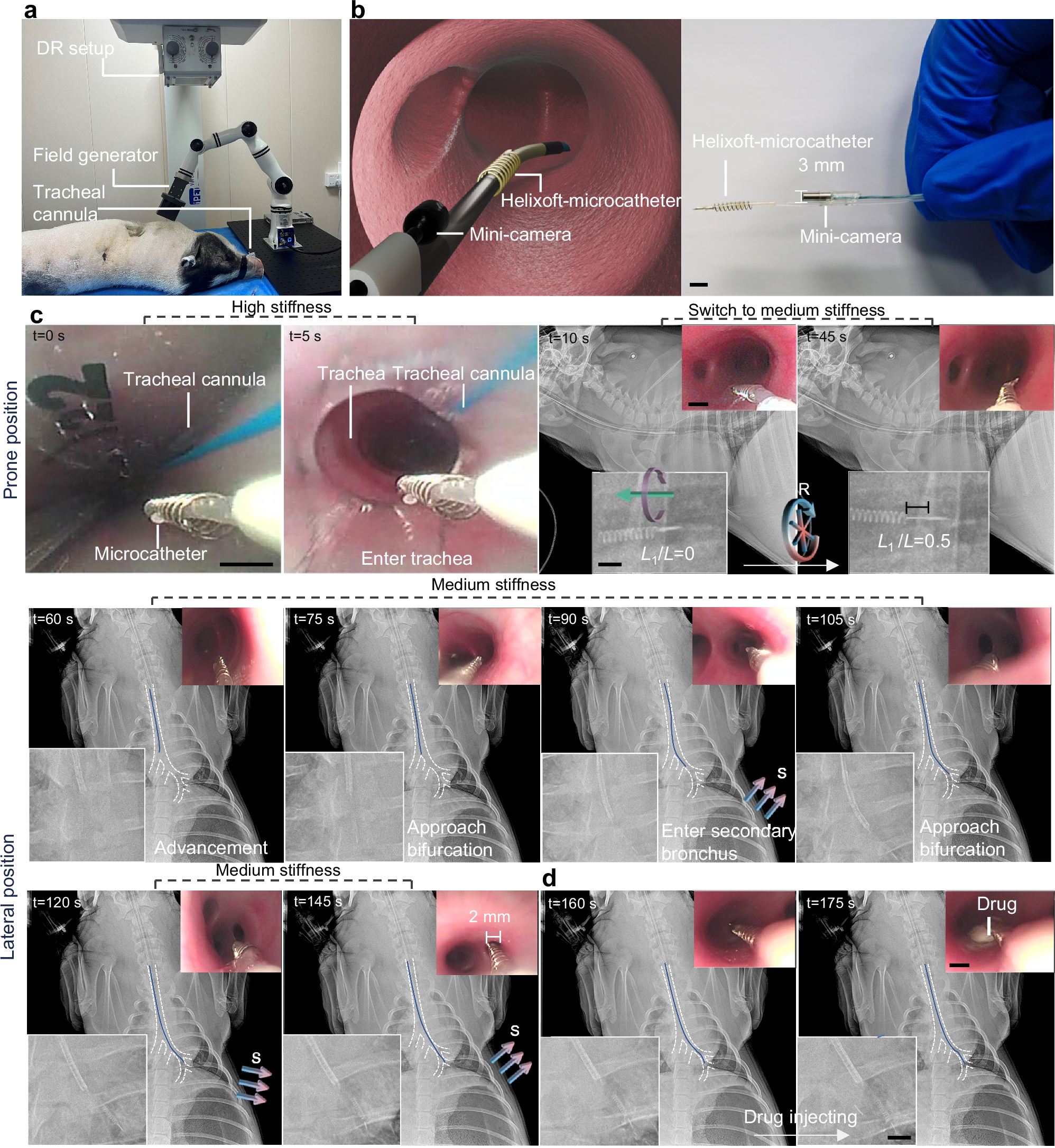 Fig. 5: Imaging-guided navigation and precision drug delivery using the Helixoft-integrated microcatheter in the quaternary bronchus of a live pig.