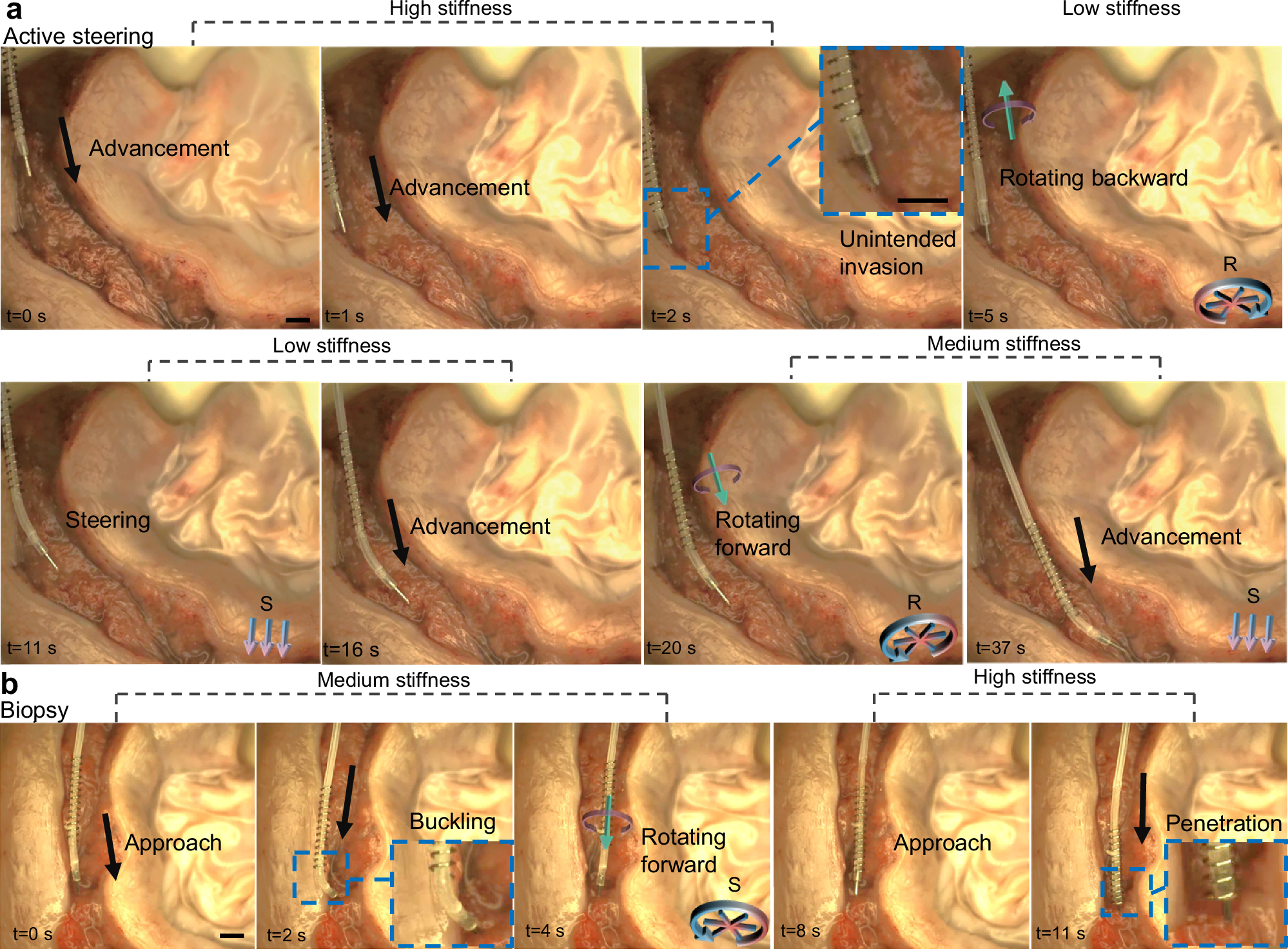 Fig. 6: Localised biopsy demonstration using the Helixoft-integrated microcatheter in an ex-vivo oviduct.