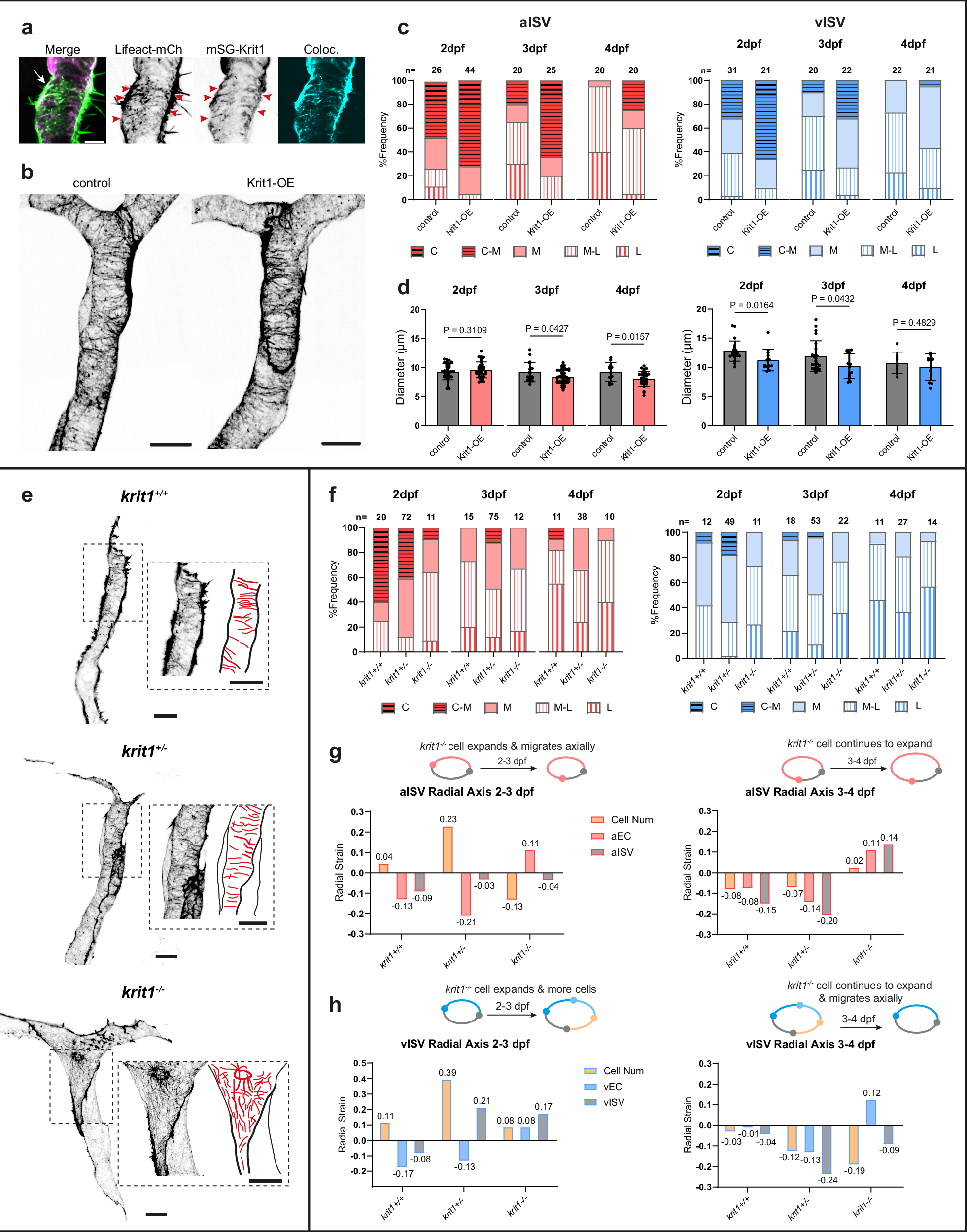 Fig. 7: Failure to assemble circumferential actin bundles in krit1-/- cells compromises cell contraction and vessel constriction.