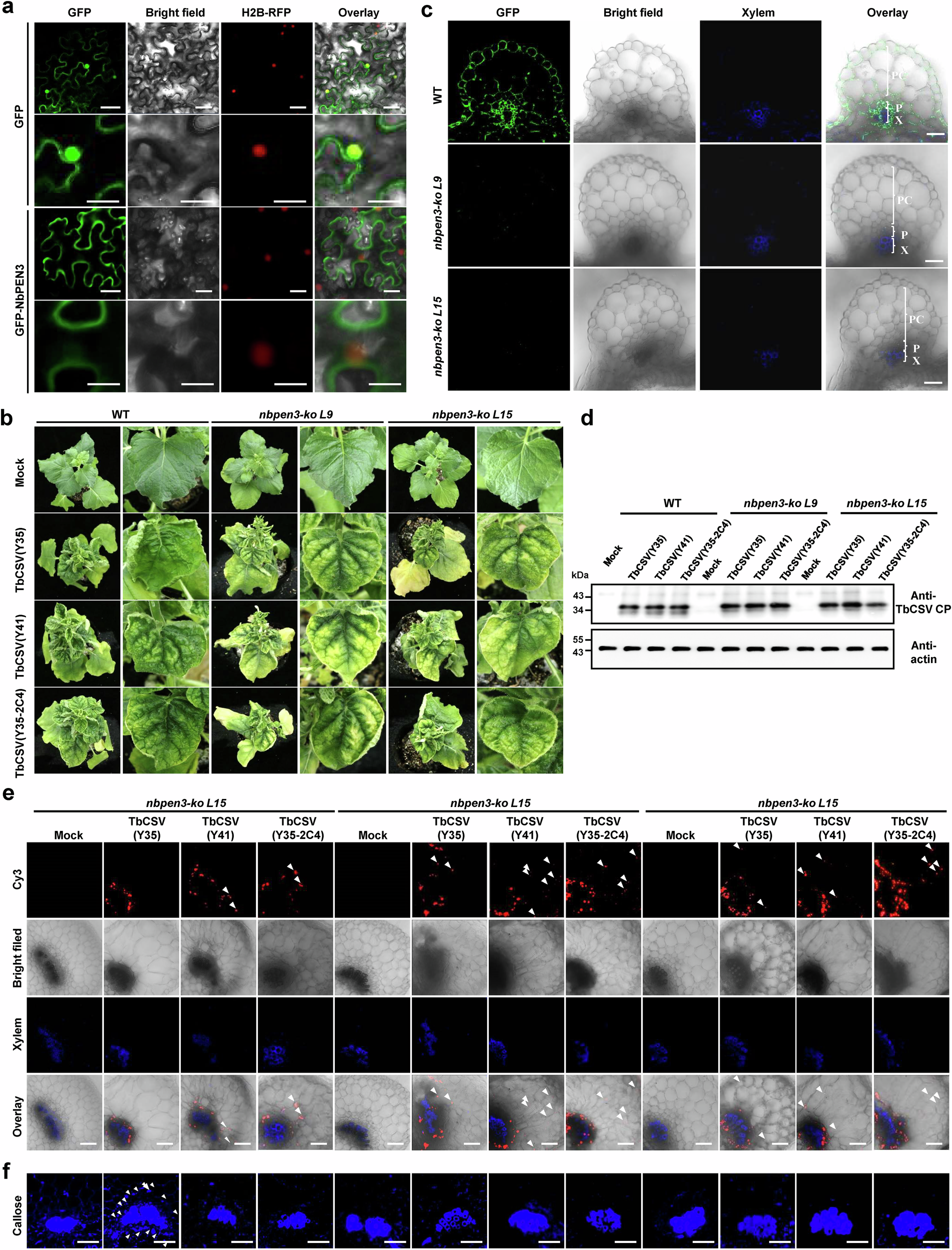 Fig. 3: NbPEN3-dependent callose deposition determines phloem restriction of TbCSV.