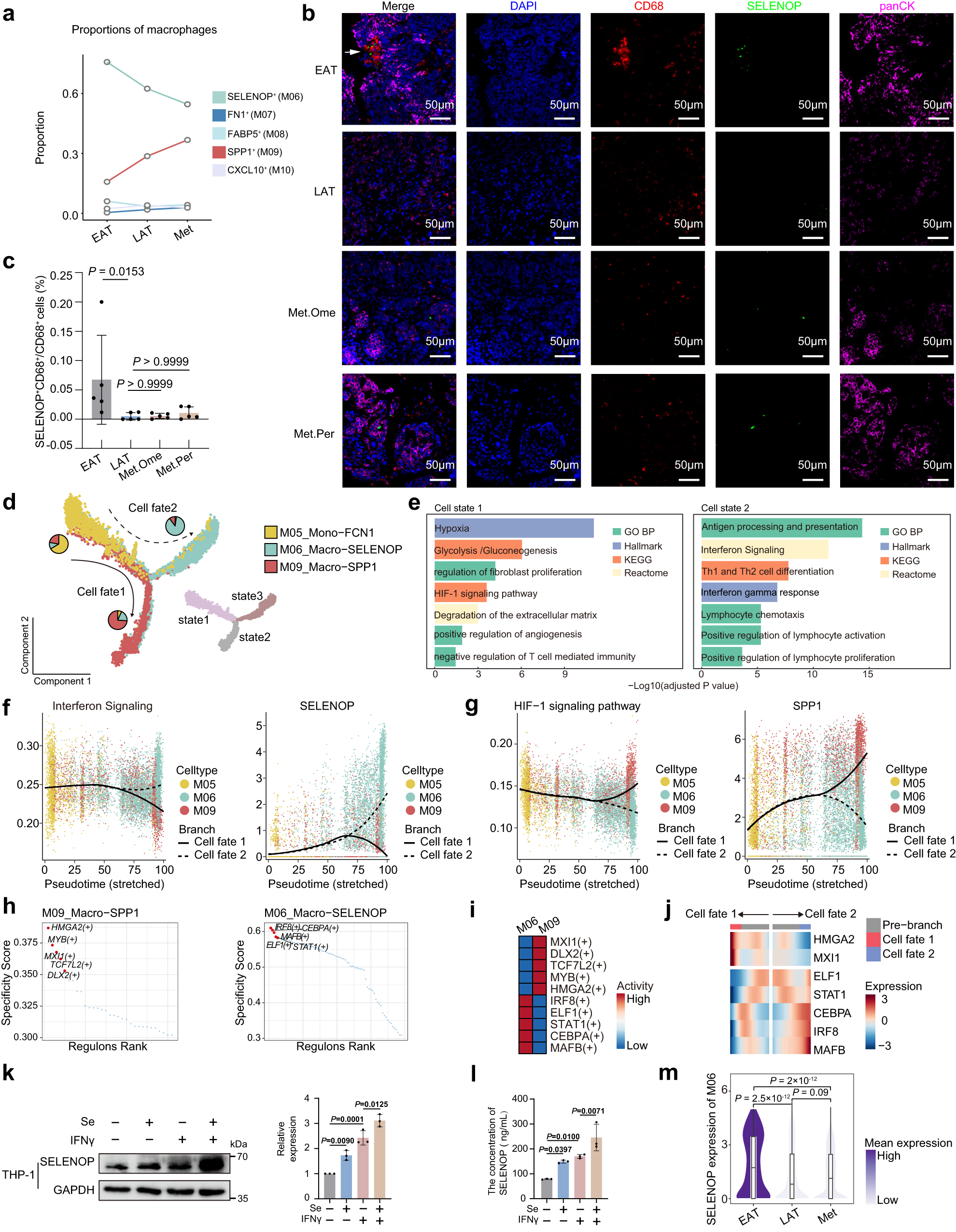 Fig. 4: Site-specific phenotypes of macrophages and functional reprogramming of SELENOP⁺ macrophages in the solid tumor microenvironment of metastatic HGSOC.