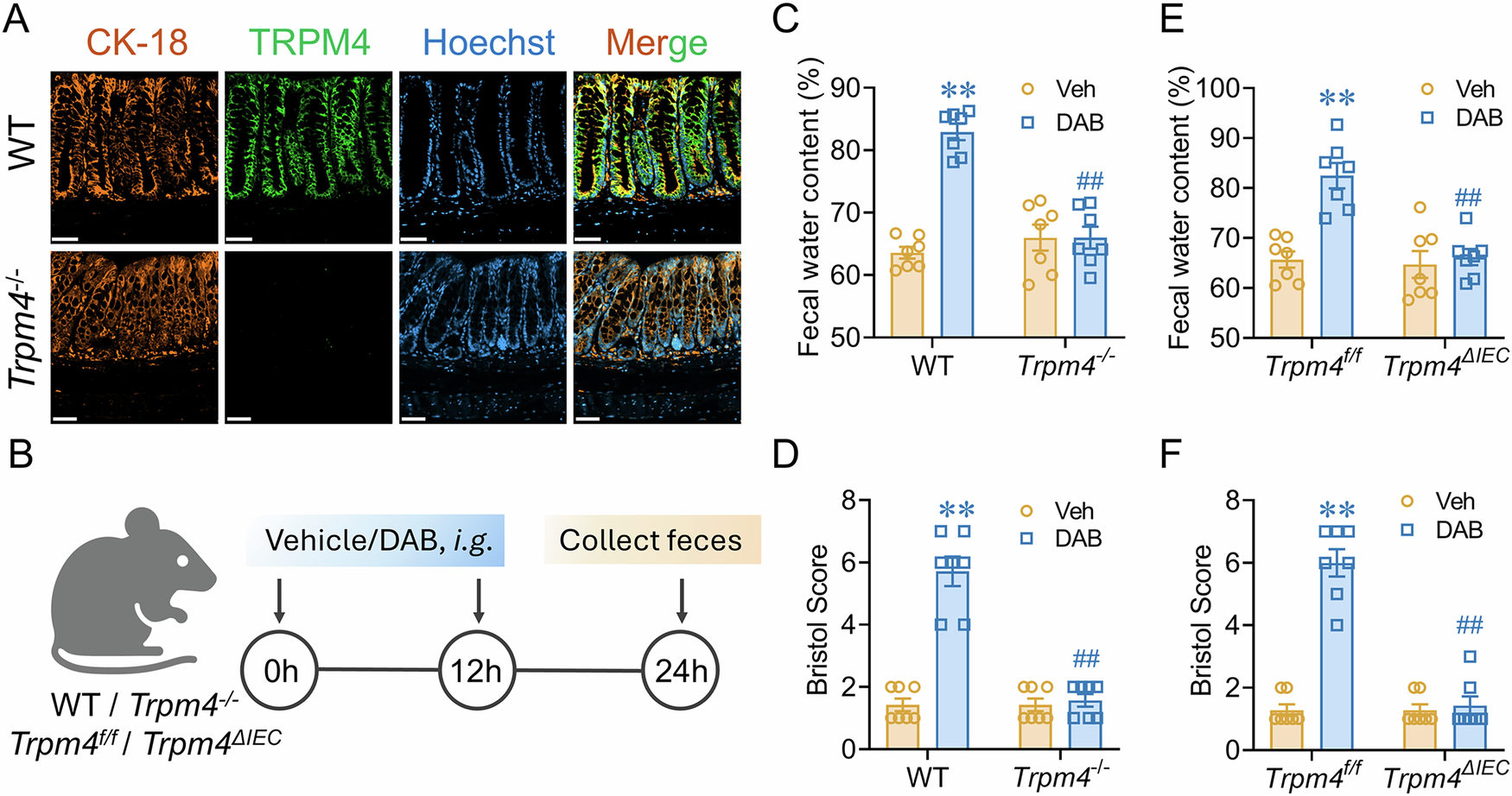Fig. 1: Deacetyl Bisacodyl (DAB) causes laxative effect through intestinal epithelial TRPM4.
