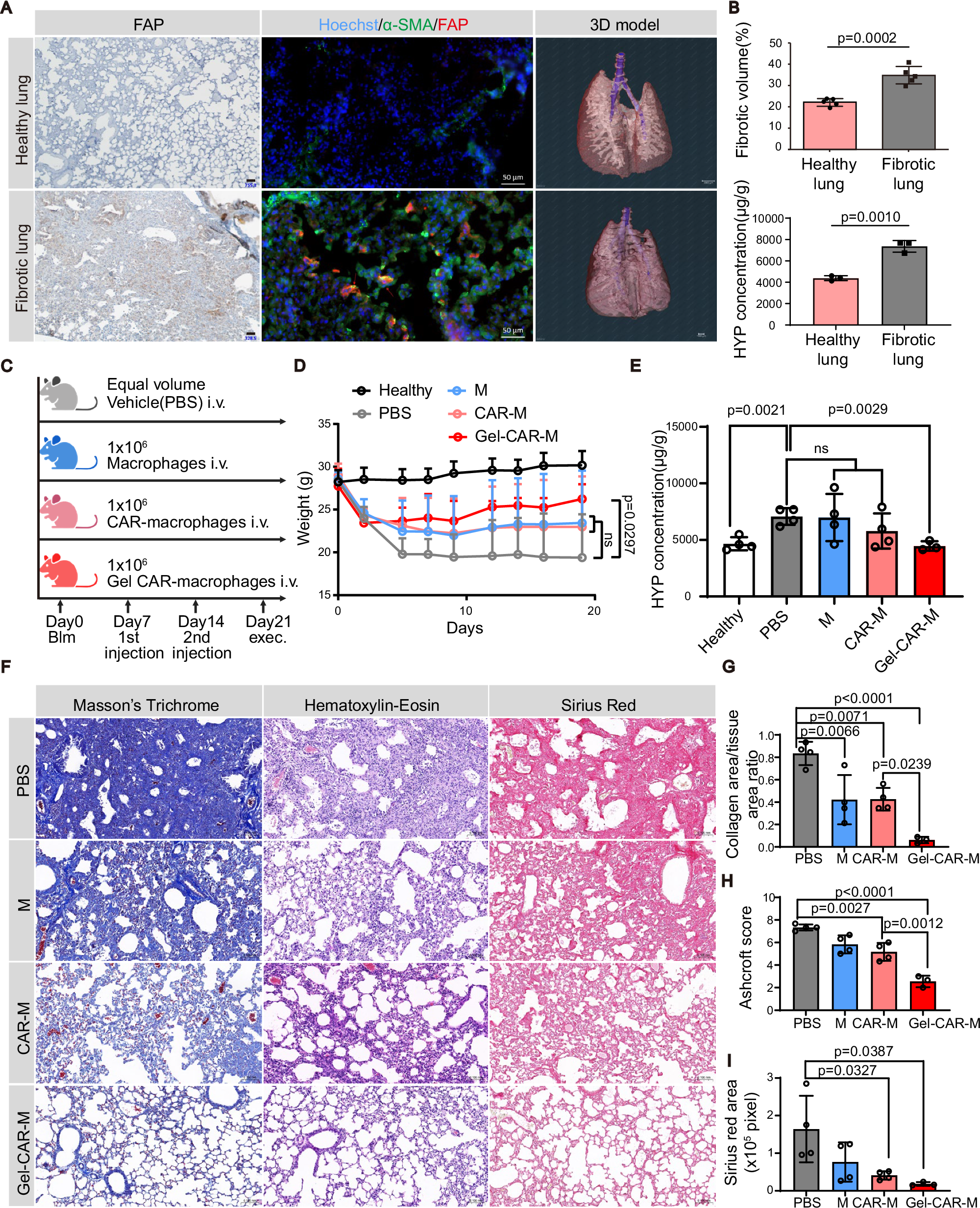Fig. 4: Hydrogel priming improved the therapeutic effect of CAR-M on murine pulmonary fibrosis model.