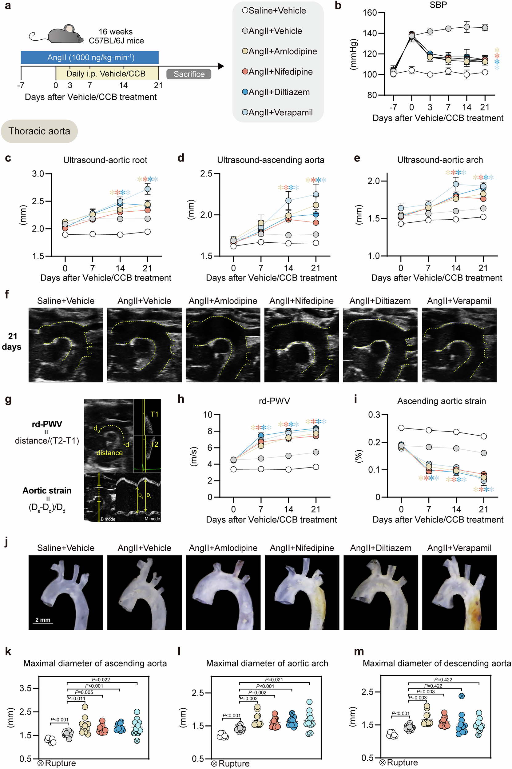 Fig. 2: CCBs (amlodipine, nifedipine, diltiazem, verapamil) aggravated thoracic aortic diameters in Ang II-induced aortic aneurysm mouse model.