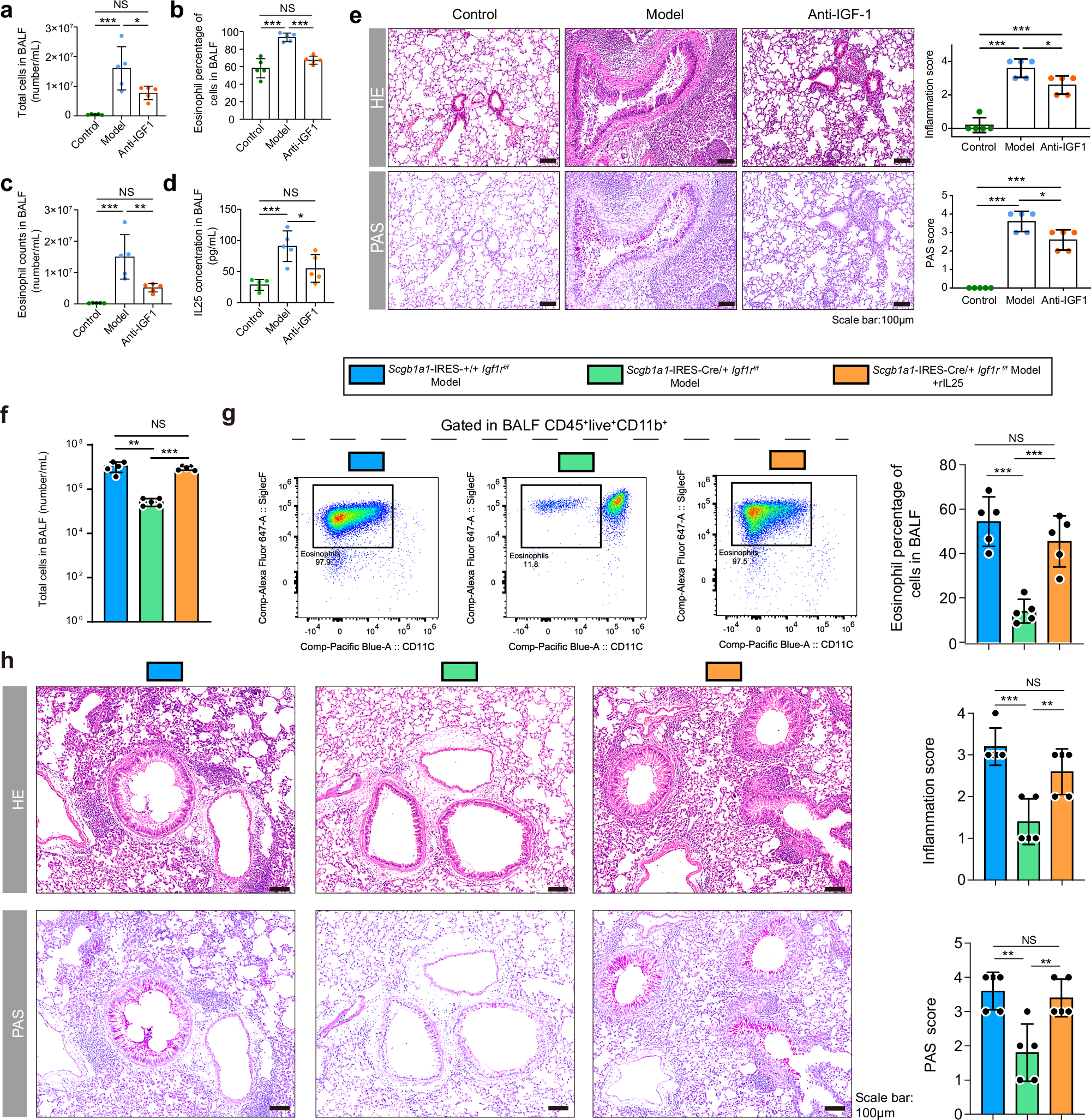 Fig. 6: Inhibition of IGF1/IGF1R signaling alleviates eosinophilic inflammation and airway remodeling via IL-25 in vivo.