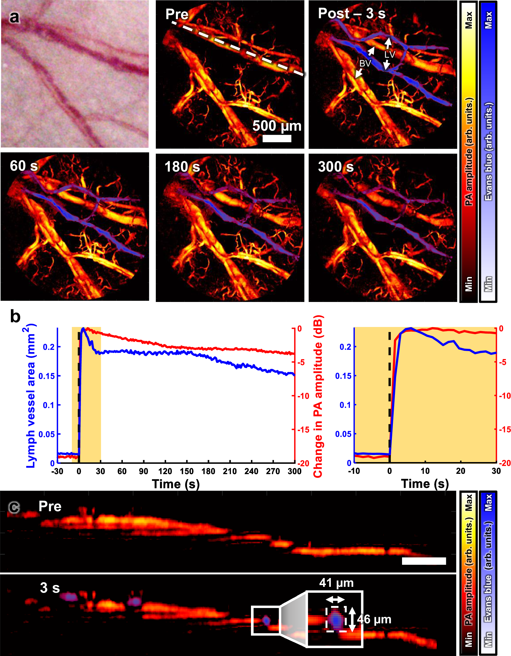 Fig. 6: PA imaging of lymphatic vessels in a mouse ear with Evans blue injection.