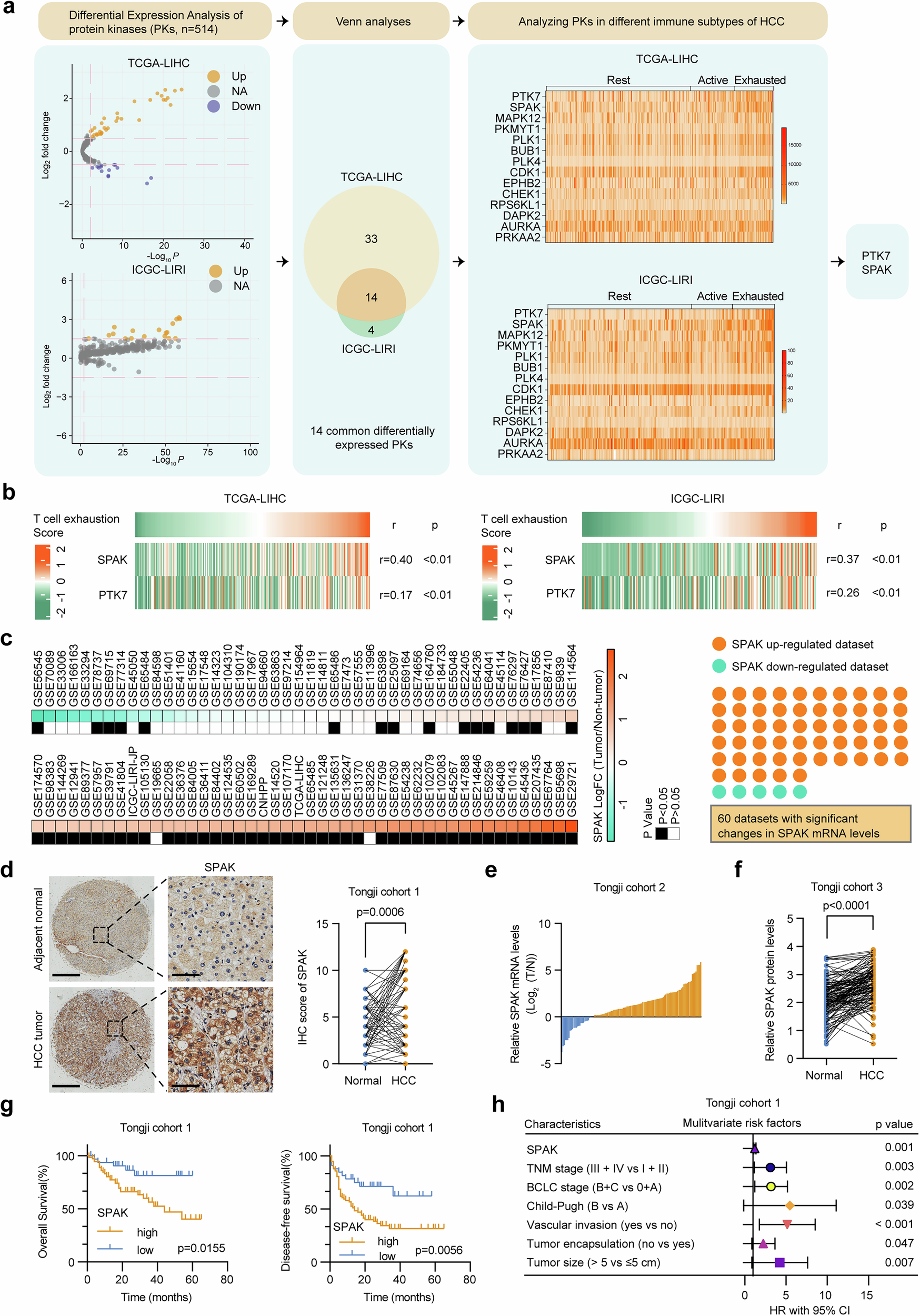 Fig. 1: High SPAK expression is associated with poor prognosis and immune exhaustion in HCC.