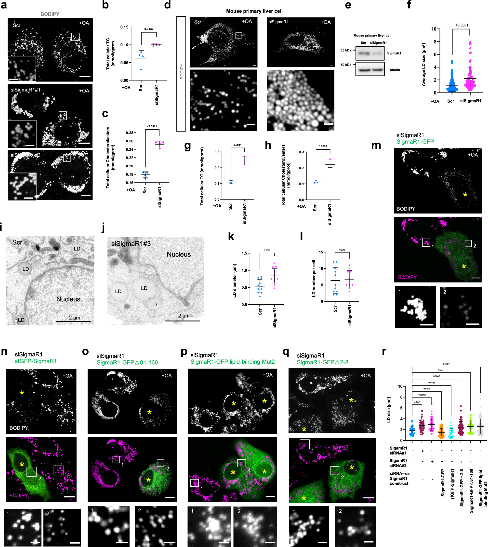 Fig. 6: SigmaR1 depletion results in accumulation of lipid droplets in hepatocytes.