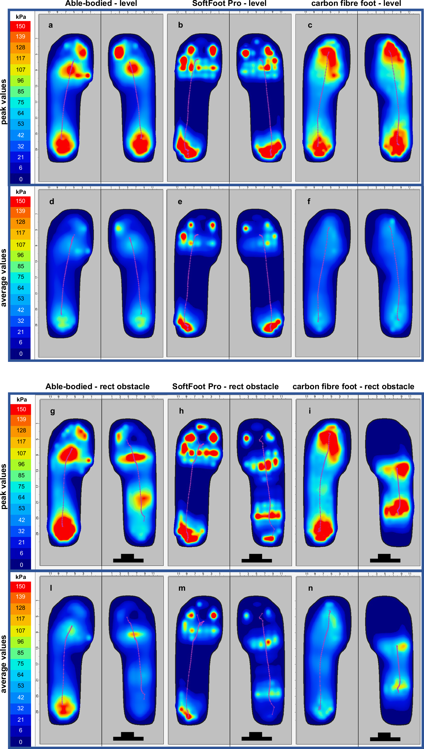 Fig. 8: Plantar pressure.